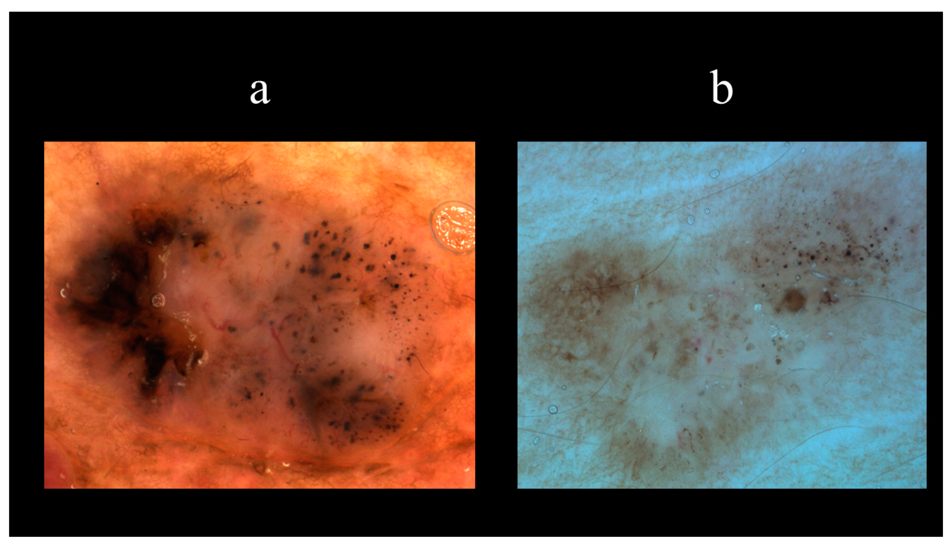 Biomedicines 08 00449 g014