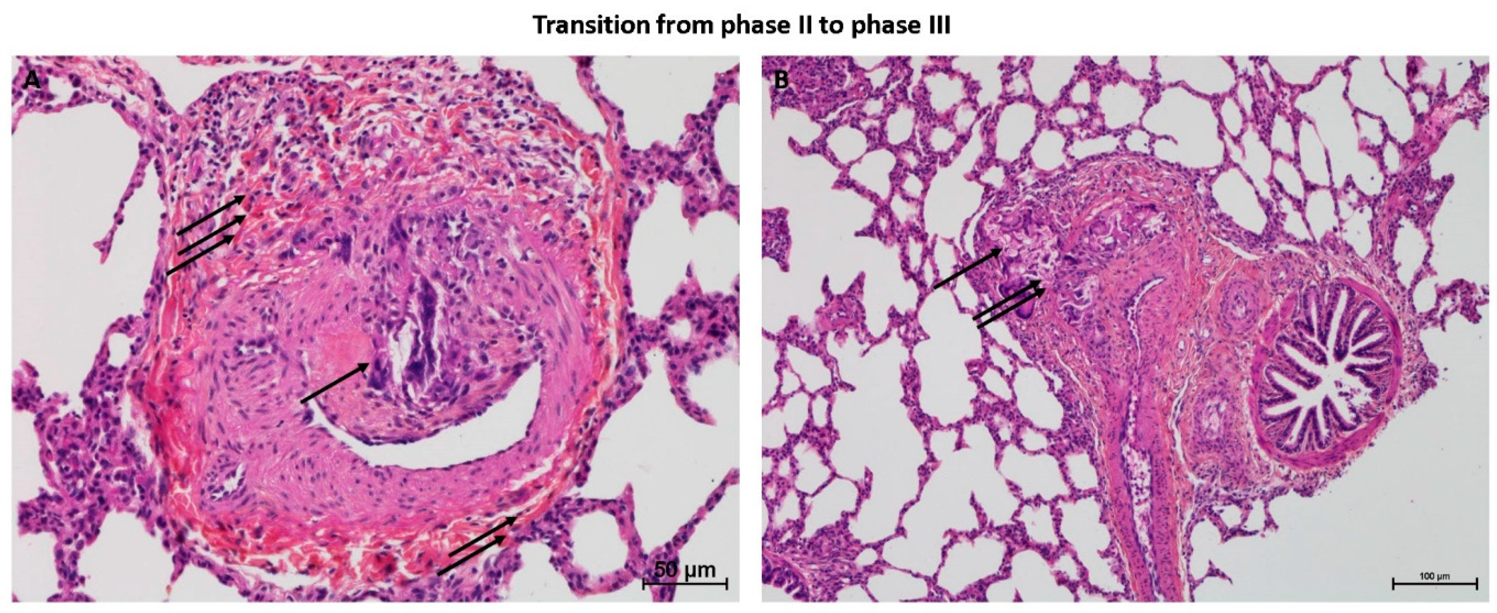 Biomedicines 08 00493 g004