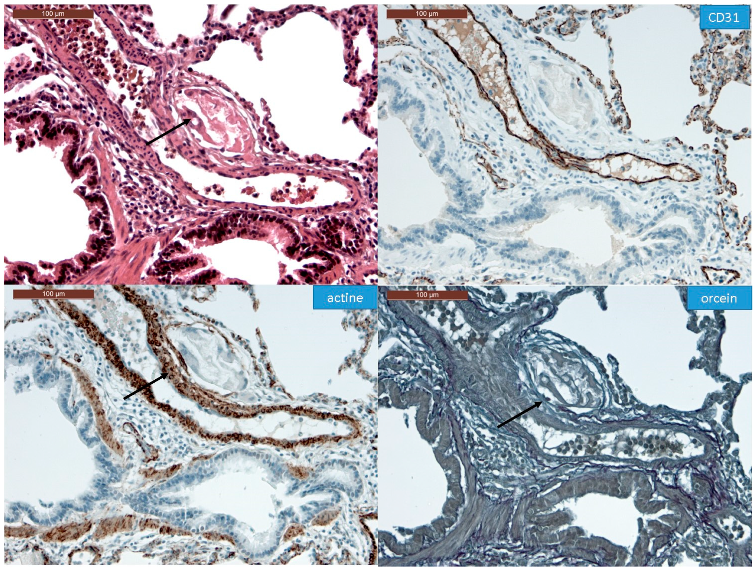 Biomedicines 08 00493 g007