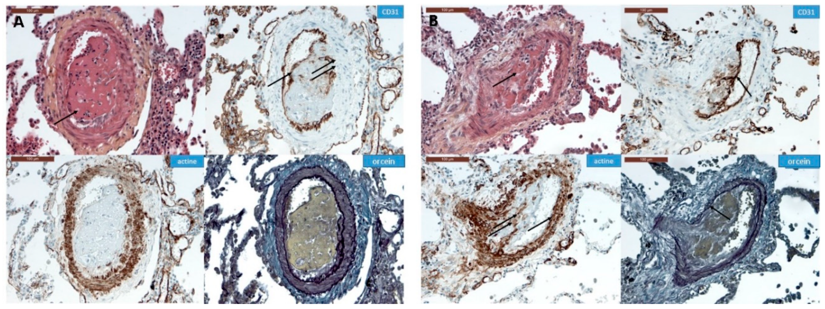 Biomedicines 08 00493 g009