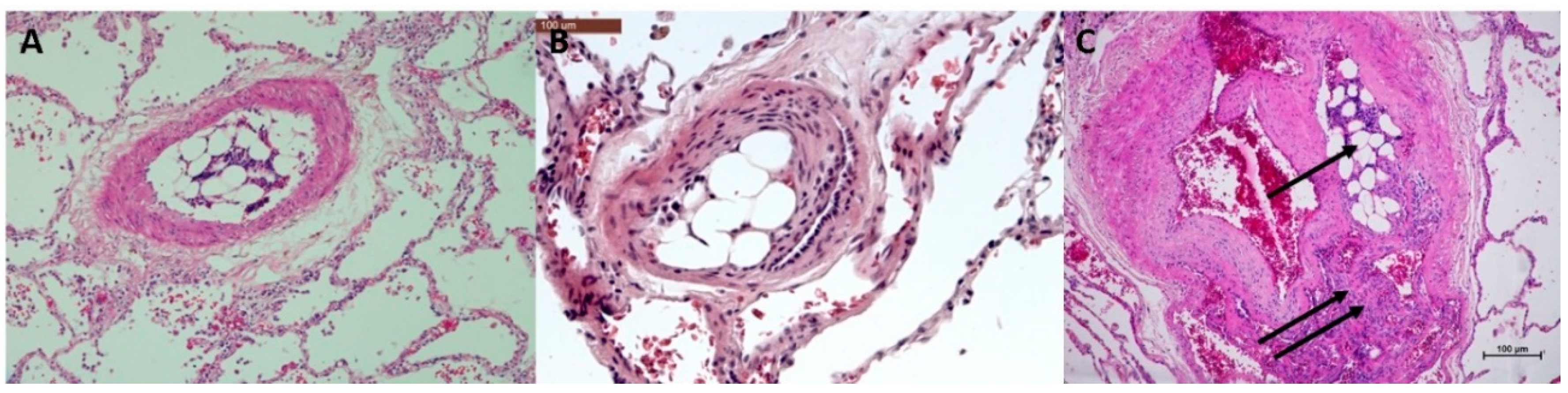 Biomedicines 08 00493 g011