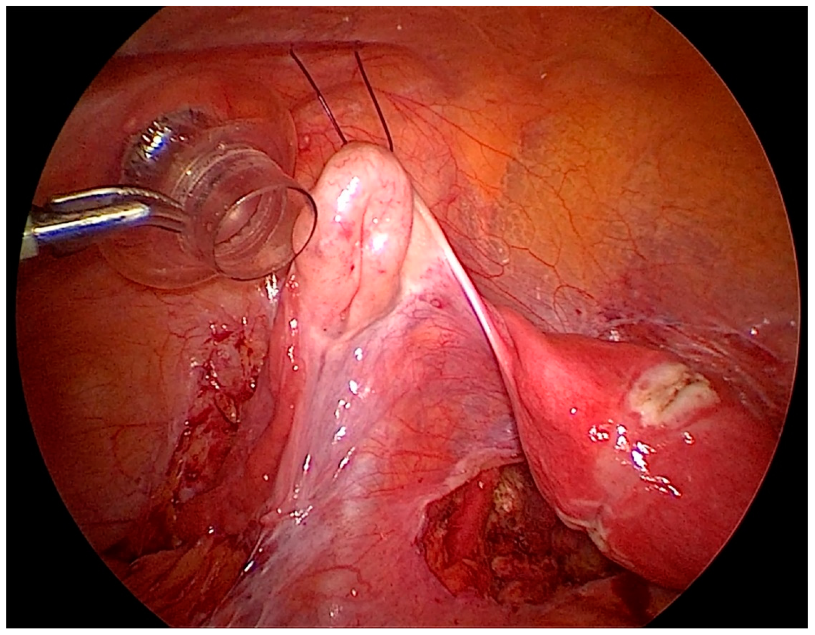 Biomedicines 08 00533 g003 Biomedicines 08 00533 g003