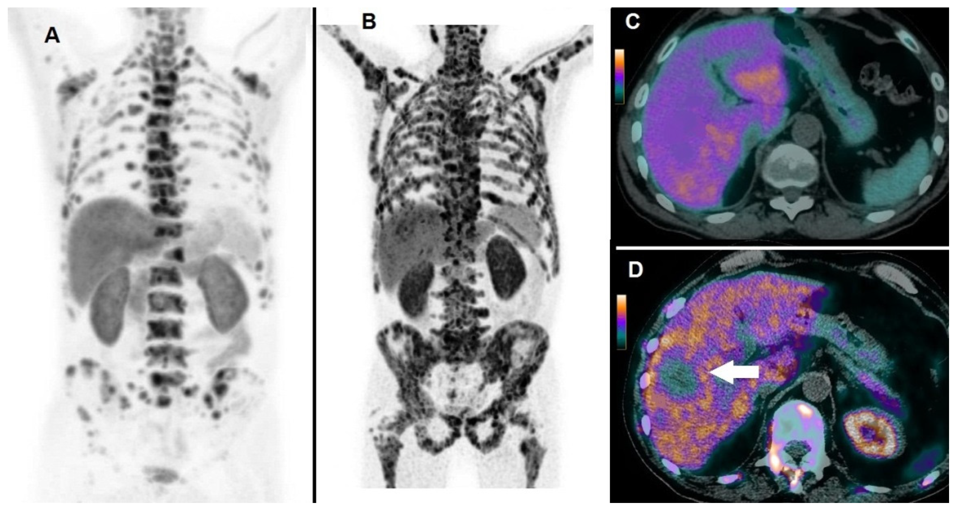Biomedicines 08 00555 g005