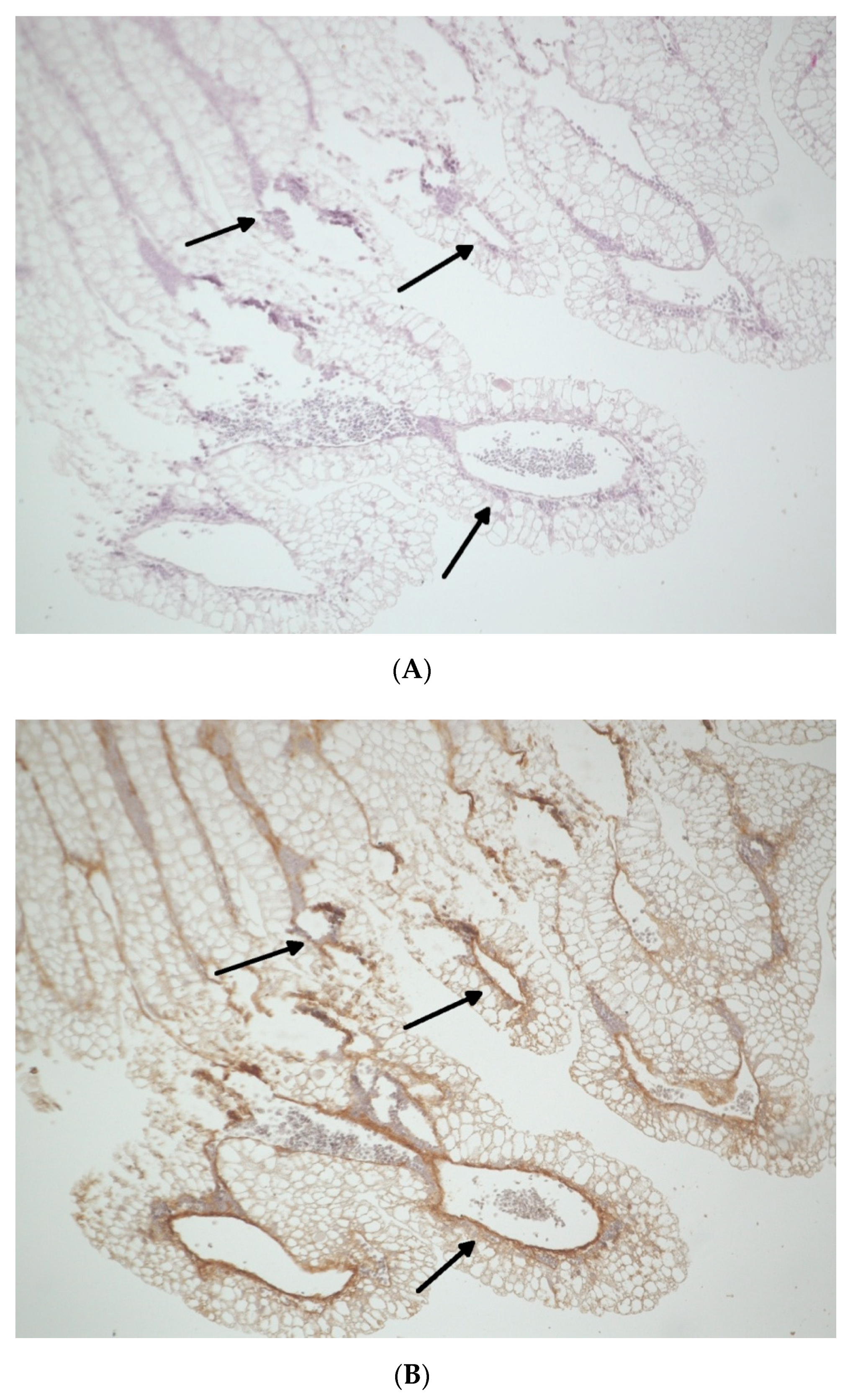 Biomedicines 09 00061 g002