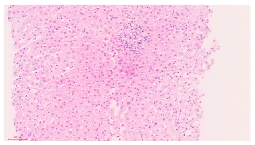 Biomedicines 09 00076 g002