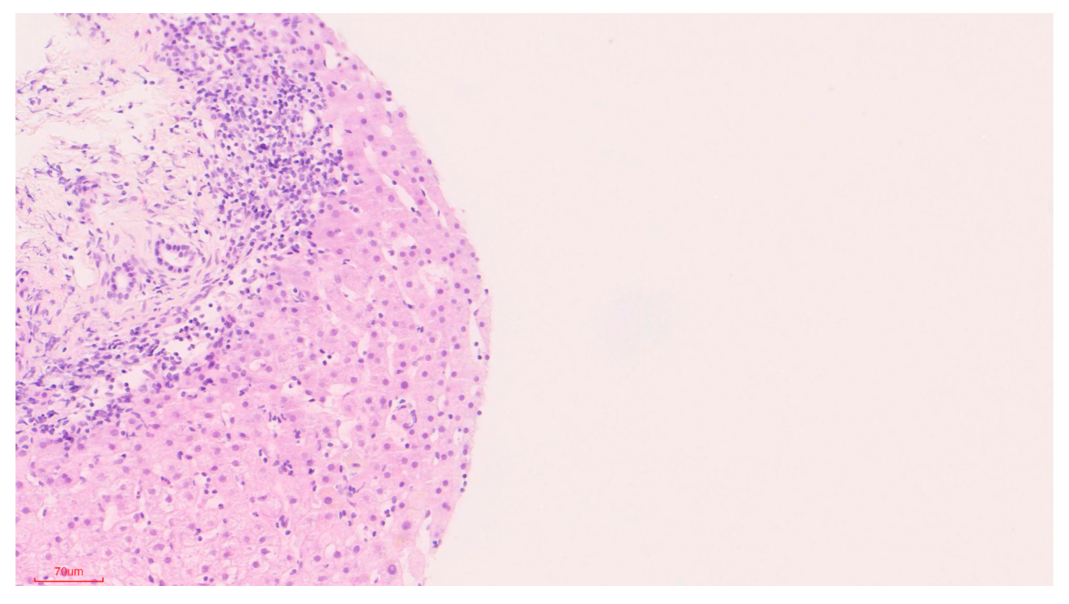 Biomedicines 09 00076 g003