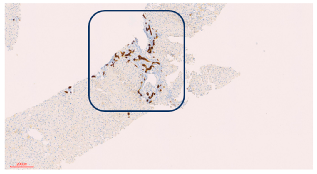 Biomedicines 09 00076 g005