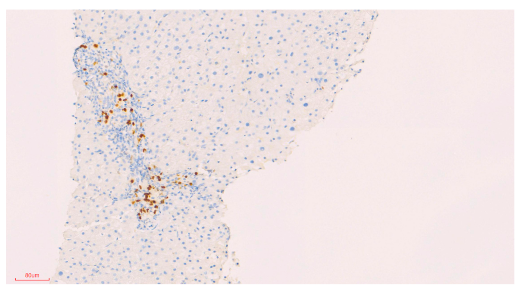 Biomedicines 09 00076 g006