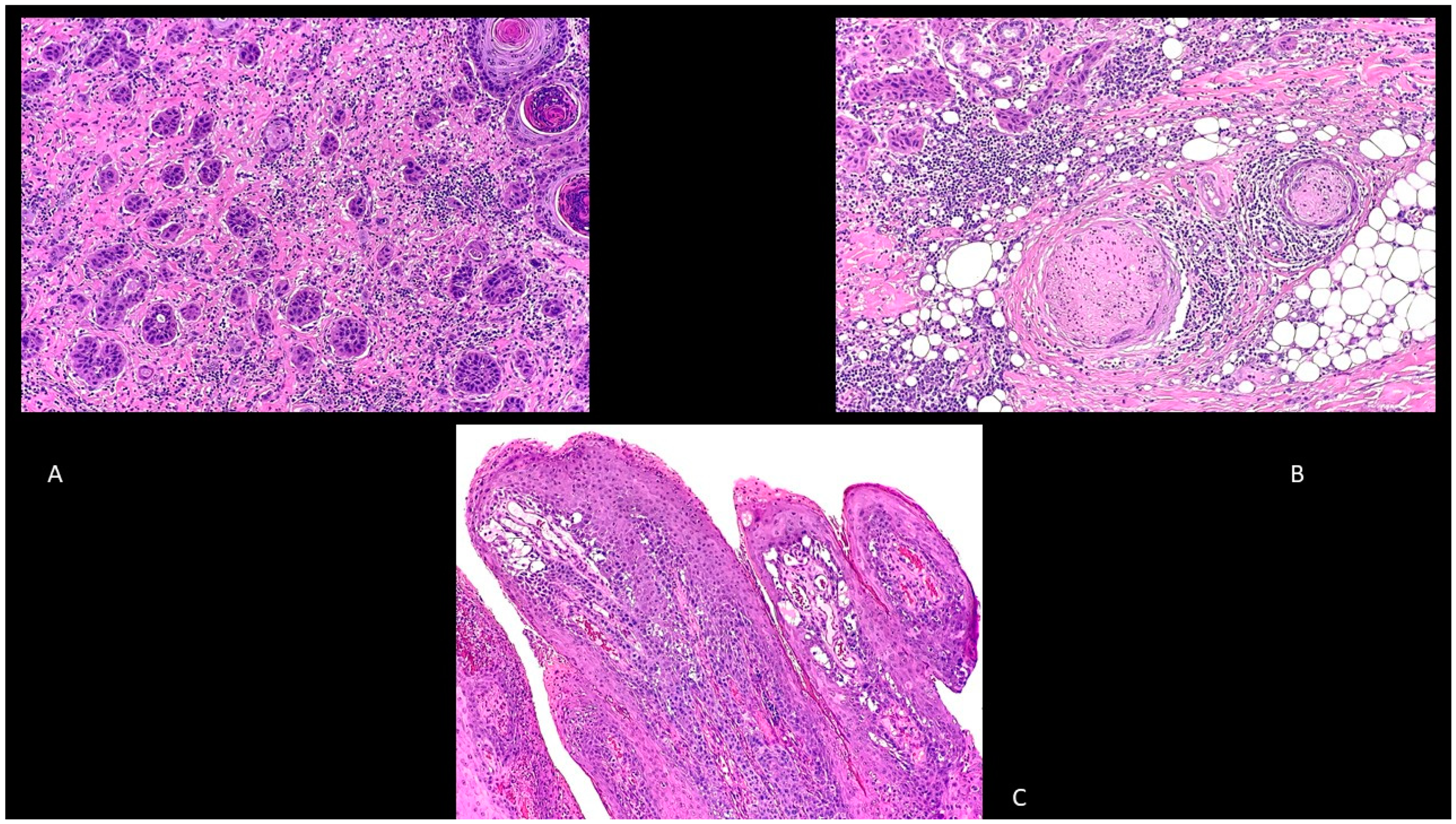 Biomedicines 09 00171 g003