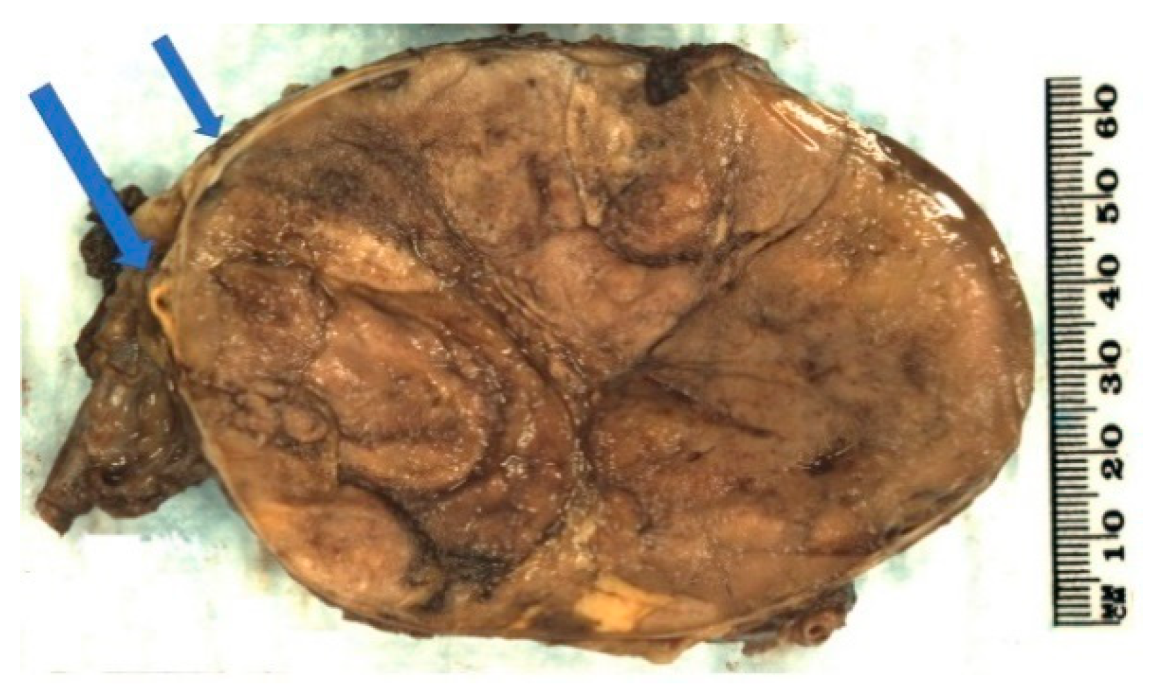 Biomedicines 09 00175 g005