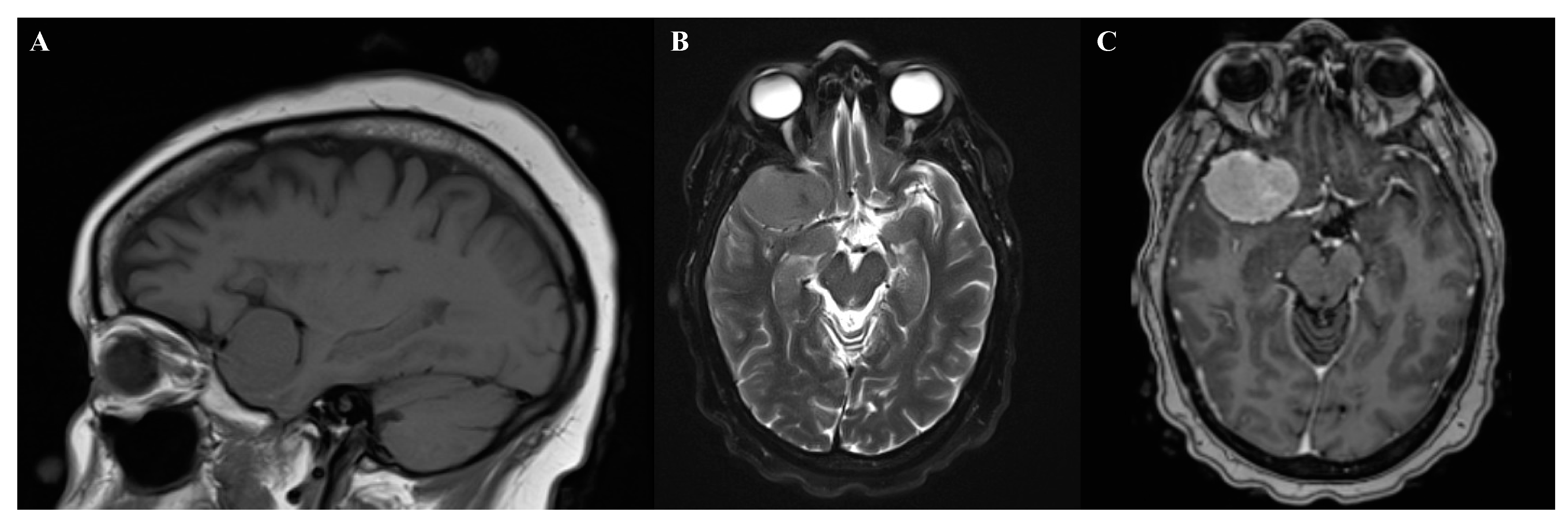 Biomedicines 09 00319 g002