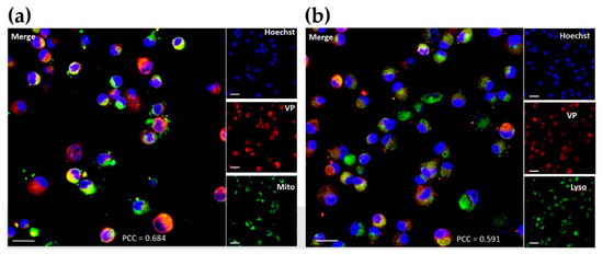 Biomedicines 09 00322 g0a3