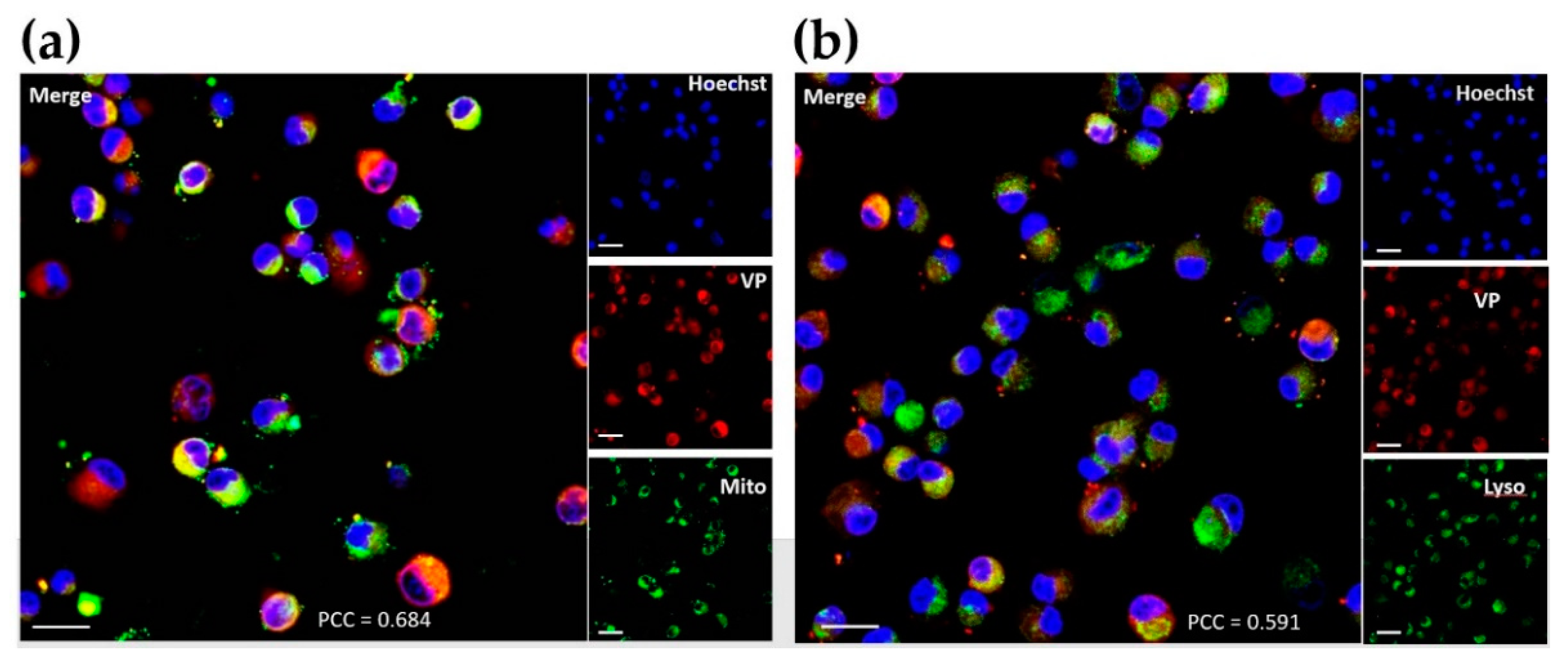 Biomedicines 09 00322 g0a3