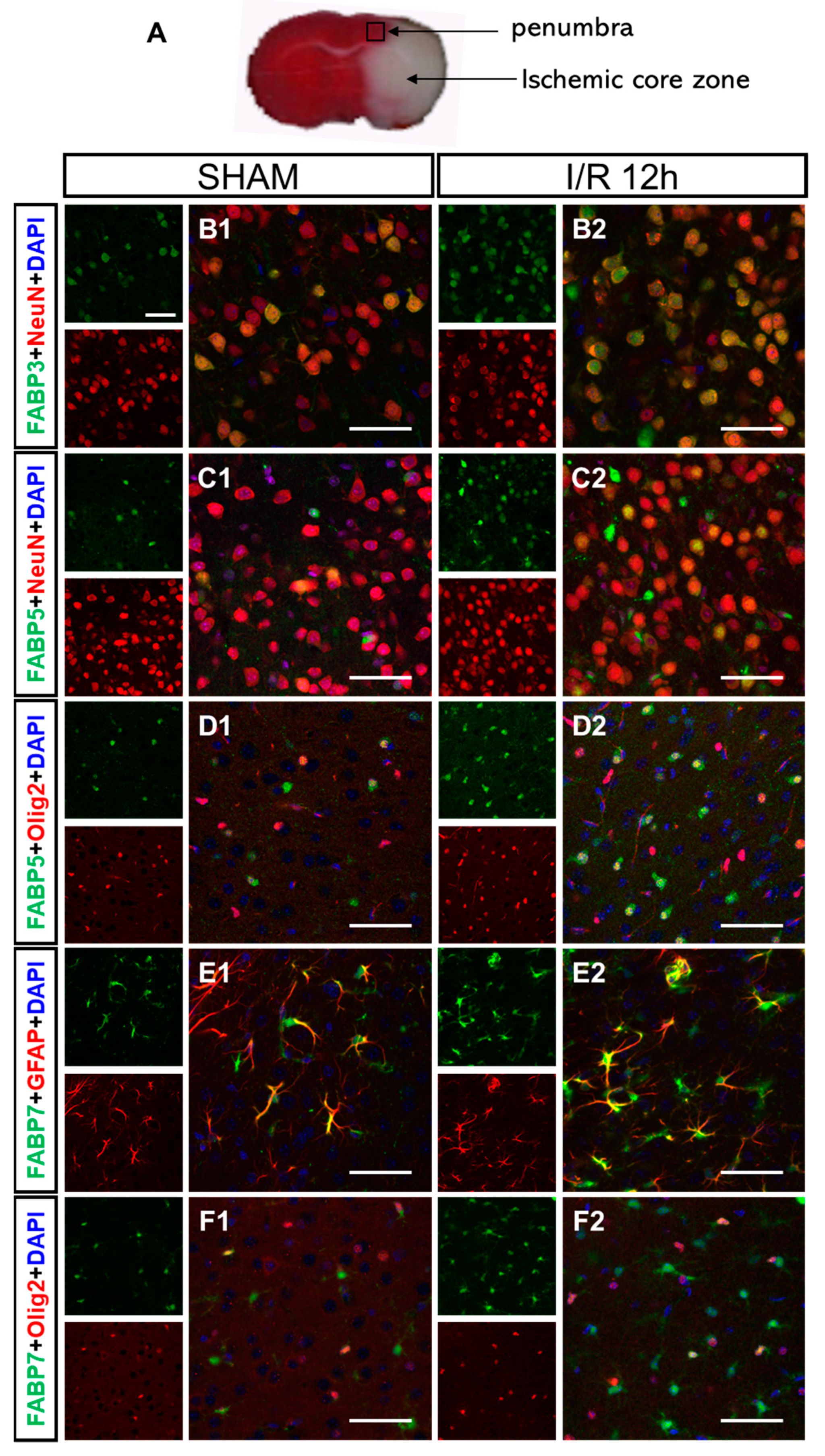 Biomedicines 09 00529 g005 Biomedicines 09 00529 g005
