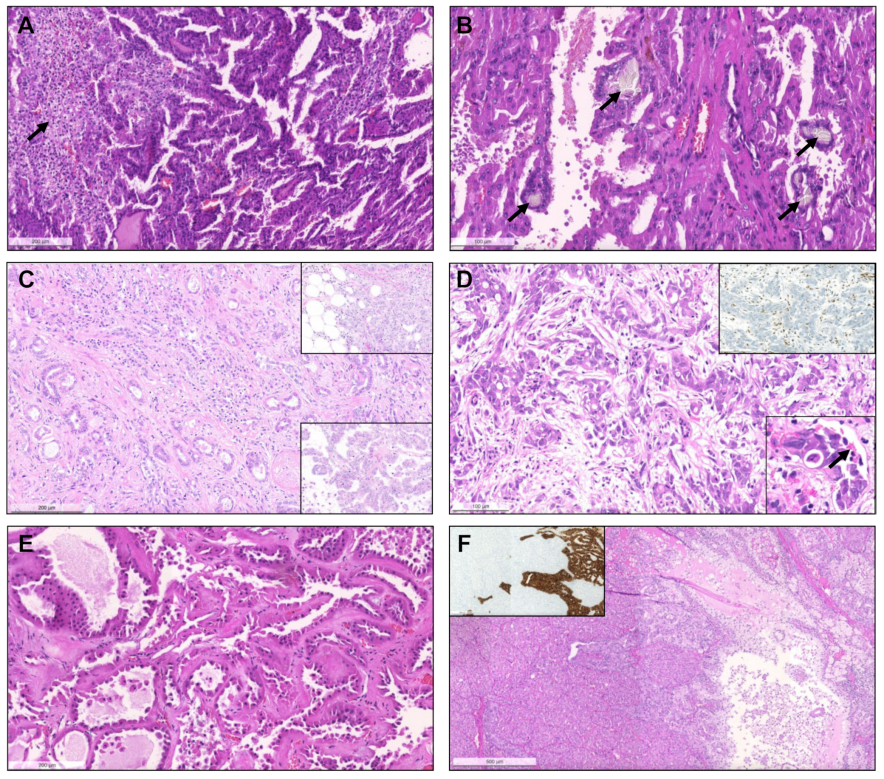 Biomedicines 09 01418 g008