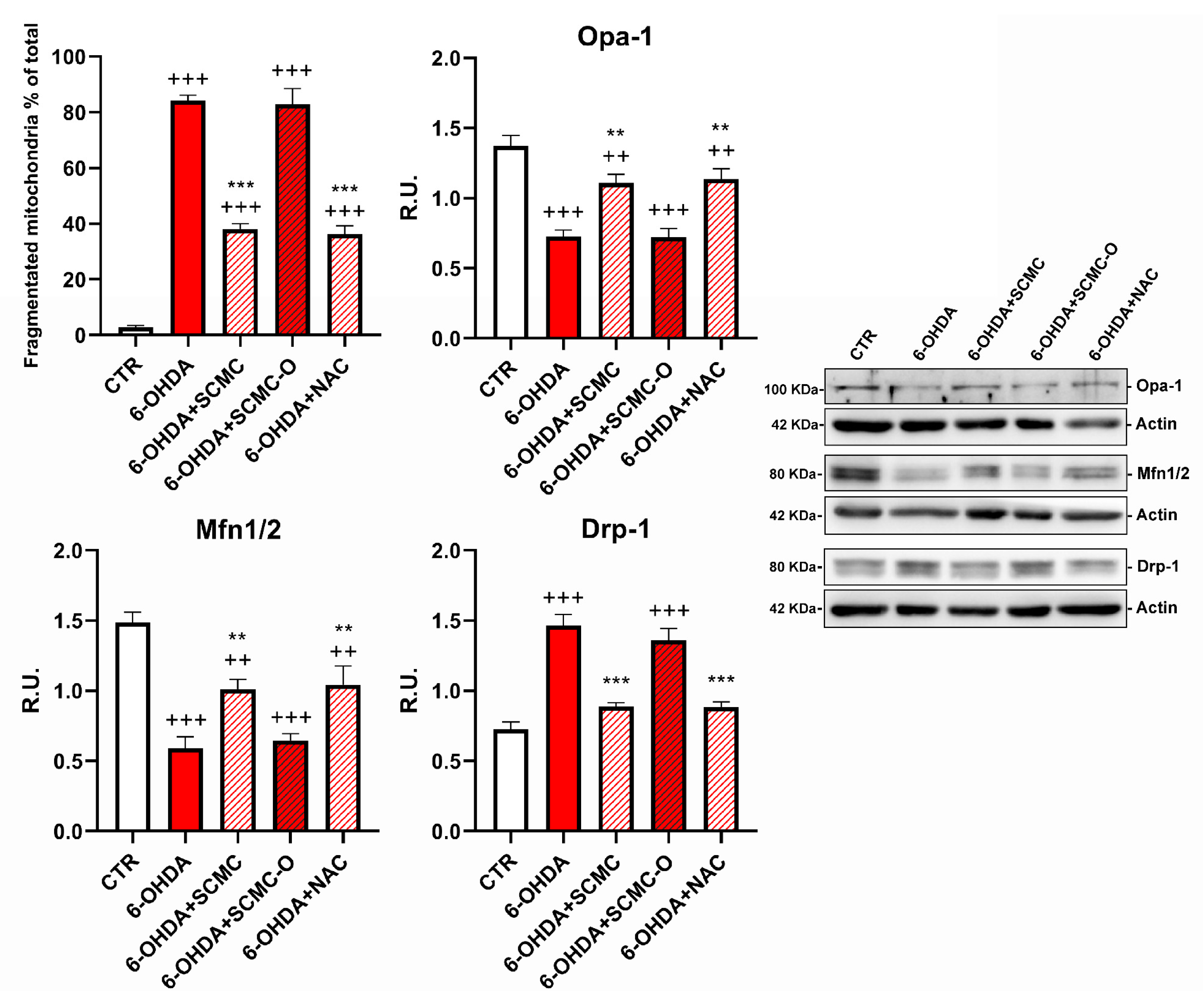 Biomedicines 09 01467 g007b
