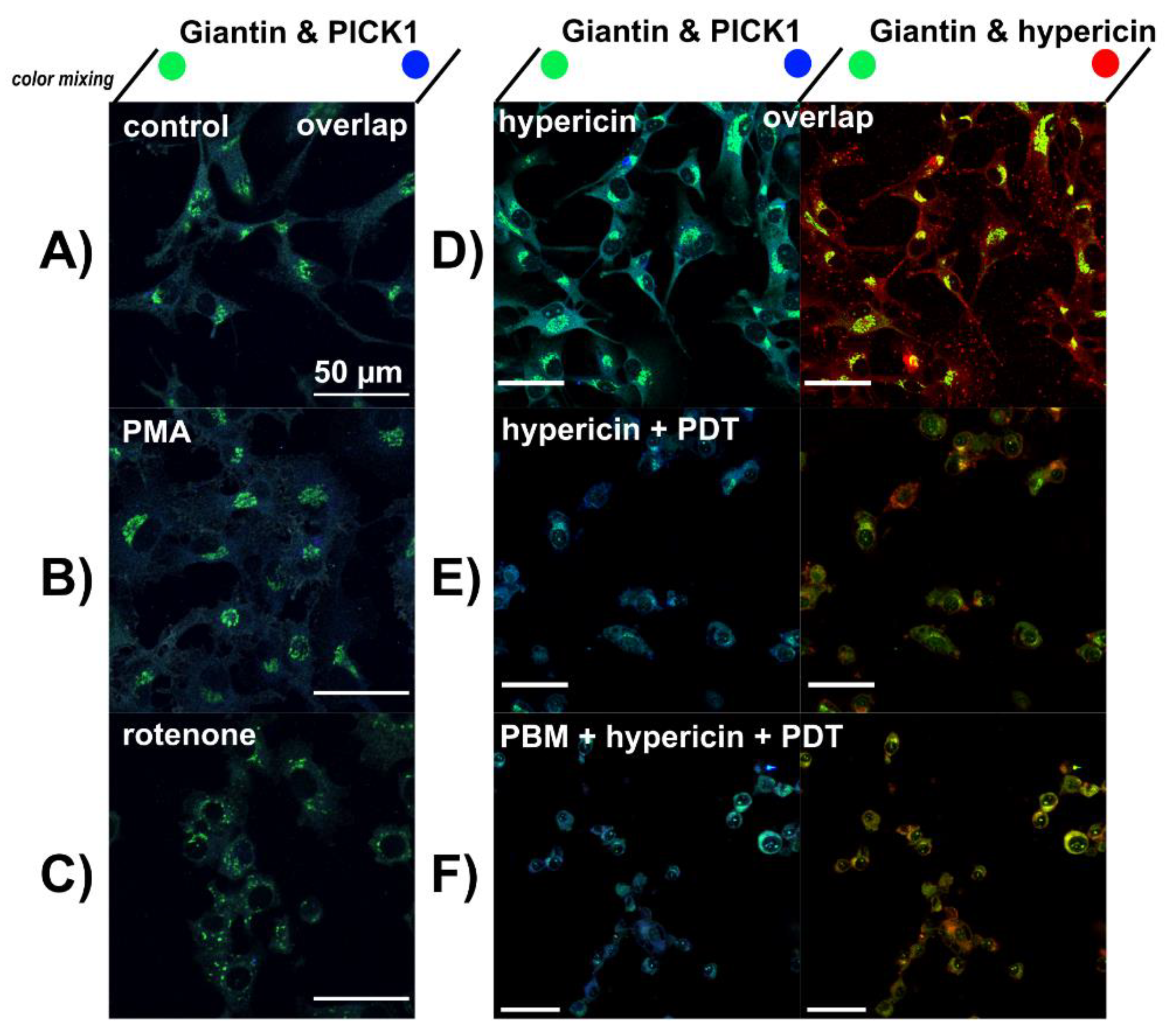 Biomedicines 09 01703 g006
