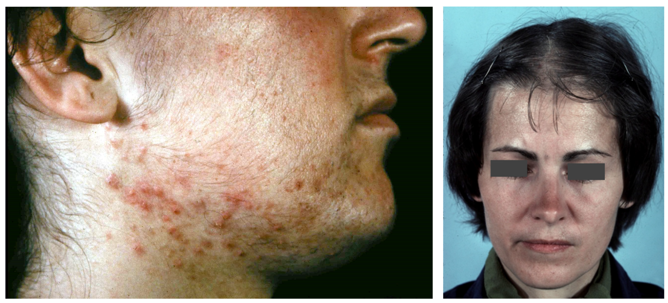 Biomedicines 09 01735 g002 Biomedicines 09 01735 g002