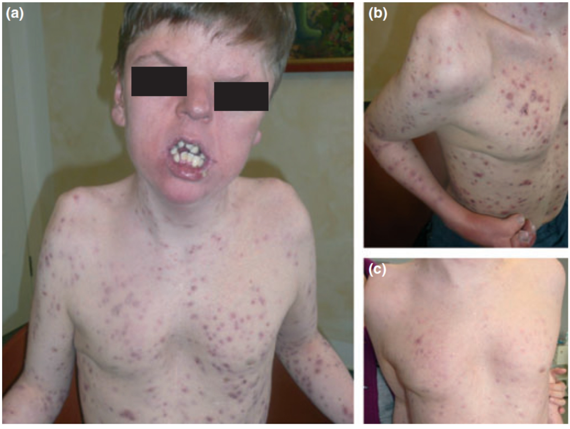 Biomedicines 09 01735 g006 Biomedicines 09 01735 g006