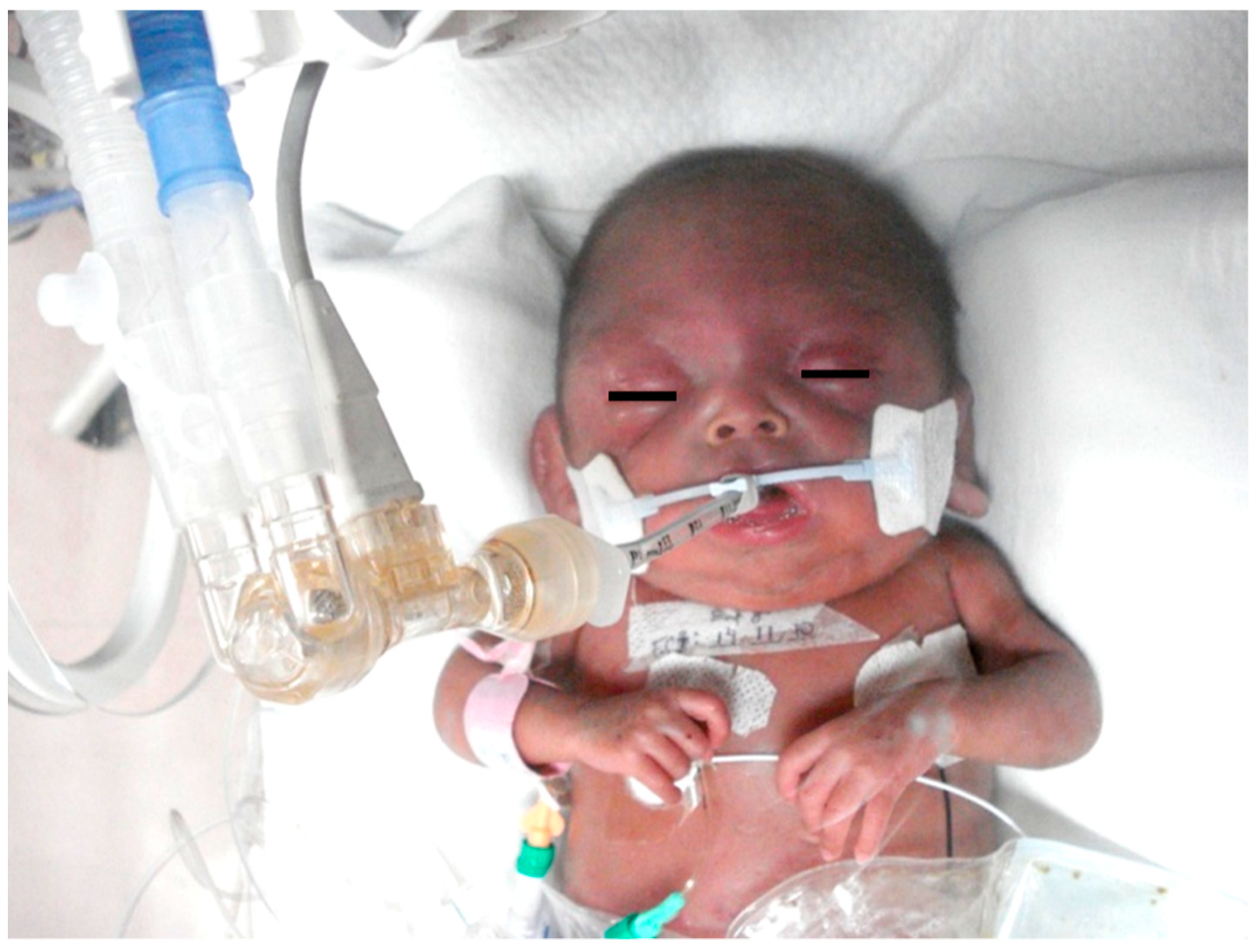 Biomedicines 10 00347 g008