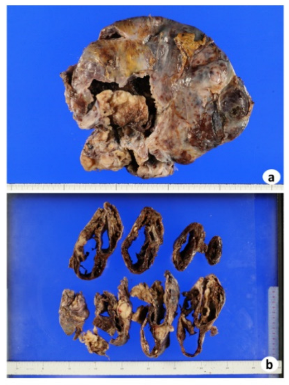 Biomedicines 10 00547 g002