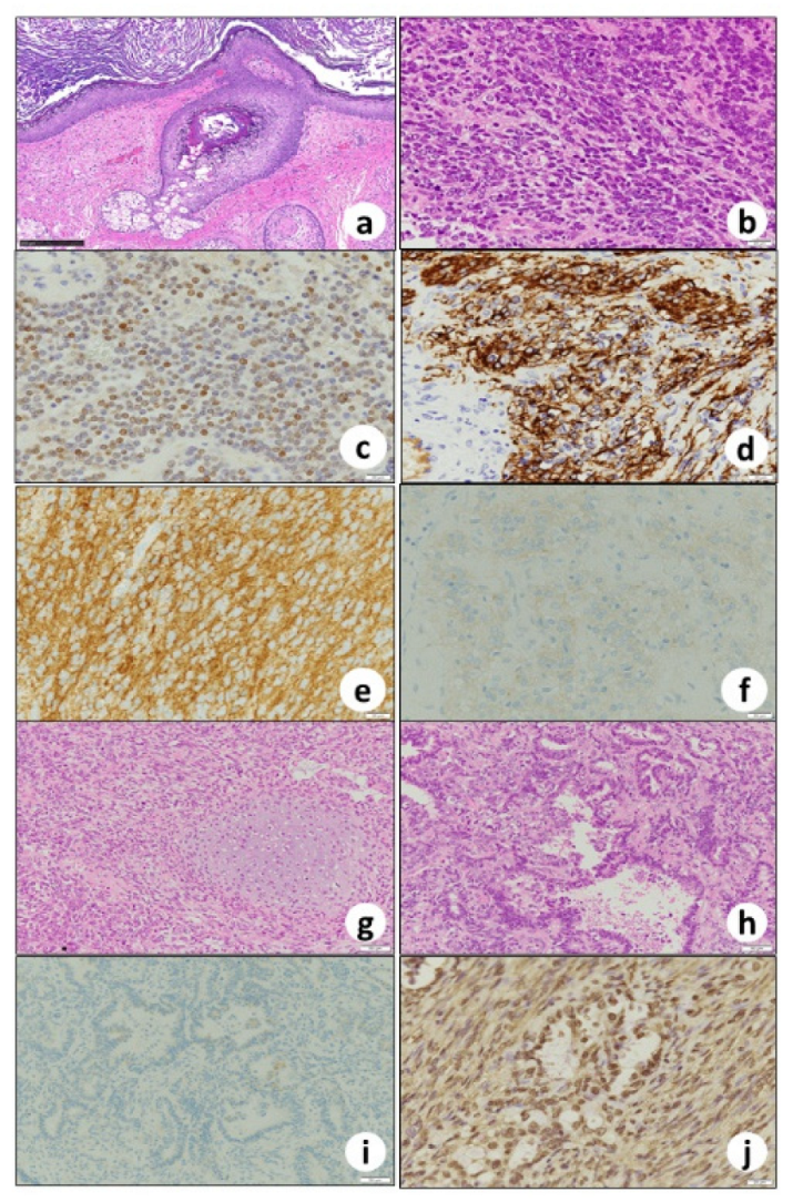 Biomedicines 10 00547 g004