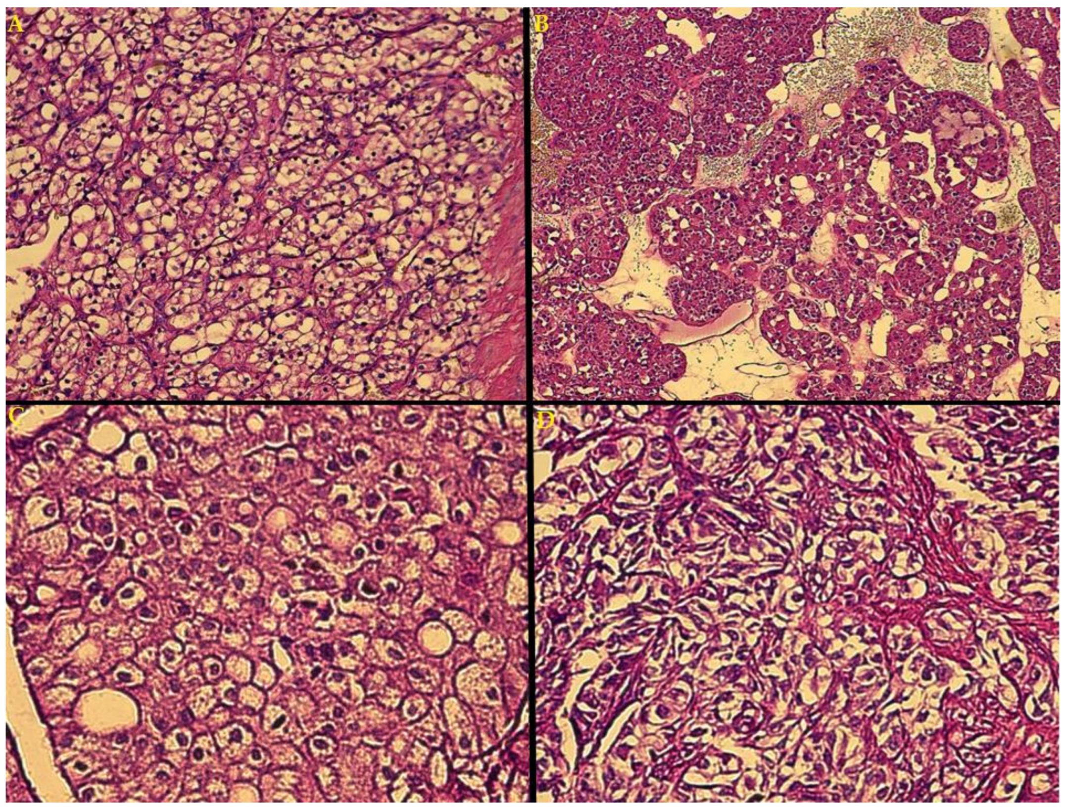 Biomedicines 10 00912 g001