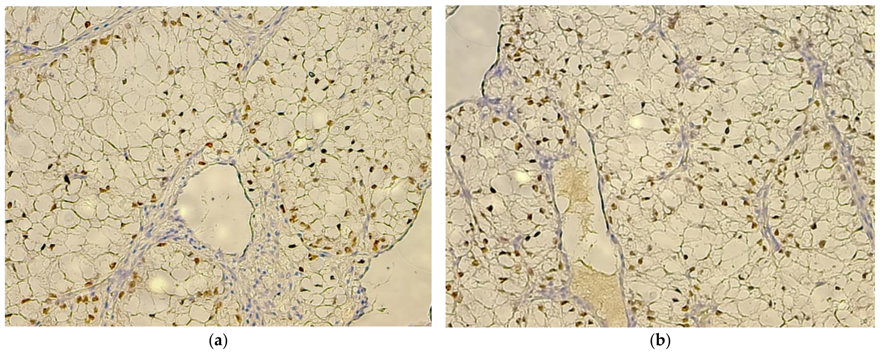 Biomedicines 10 00912 g004