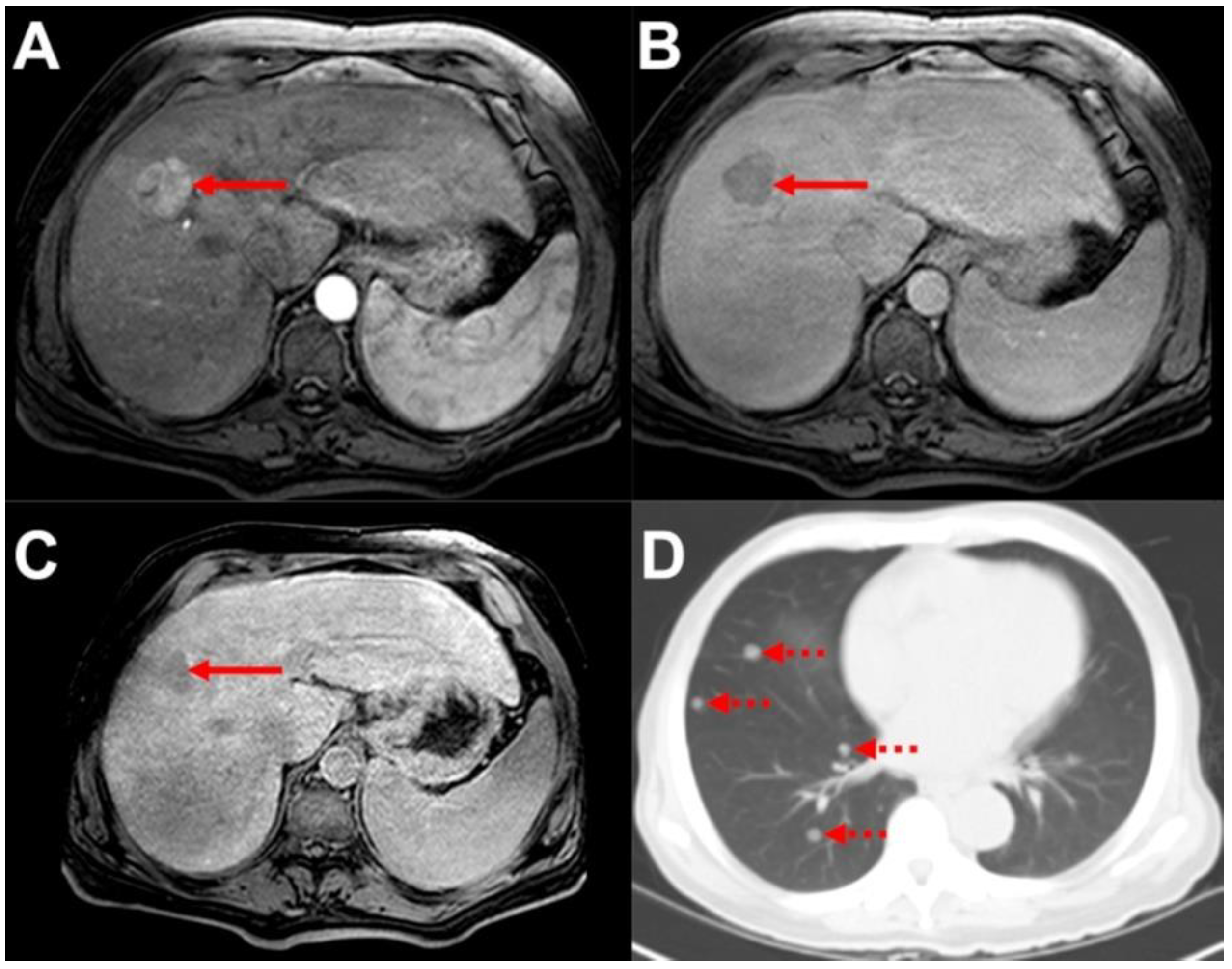 Biomedicines 10 01156 g001