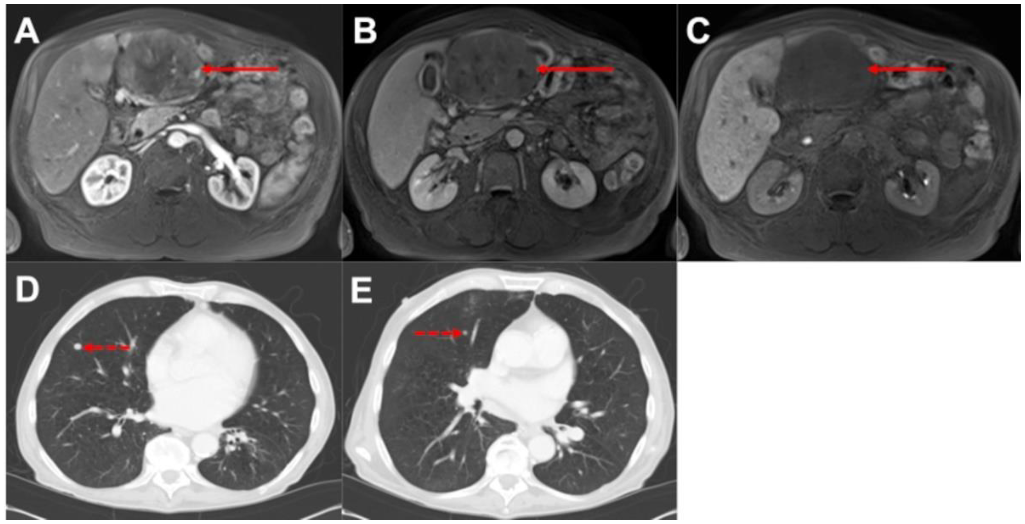 Biomedicines 10 01156 g002