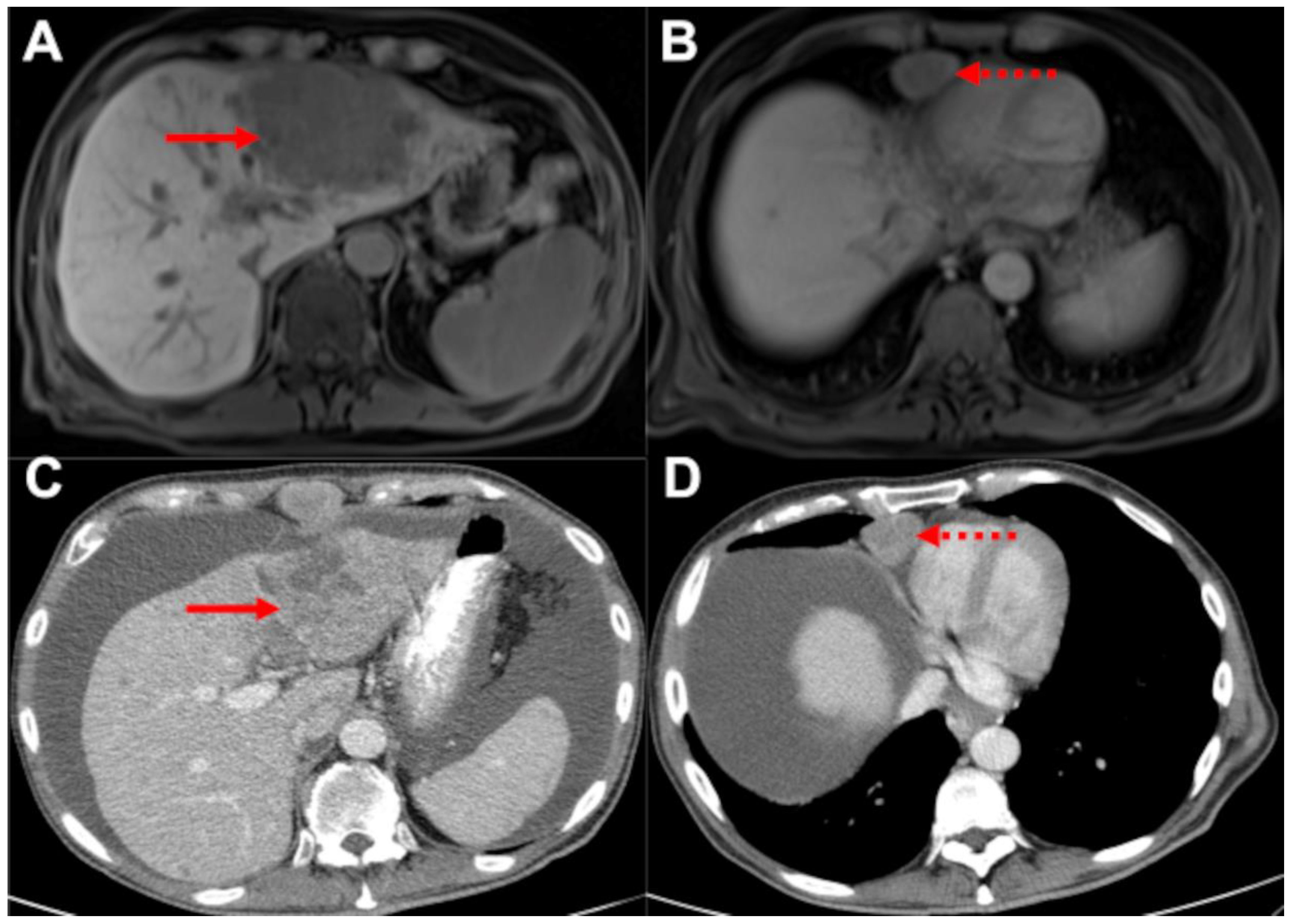 Biomedicines 10 01156 g003