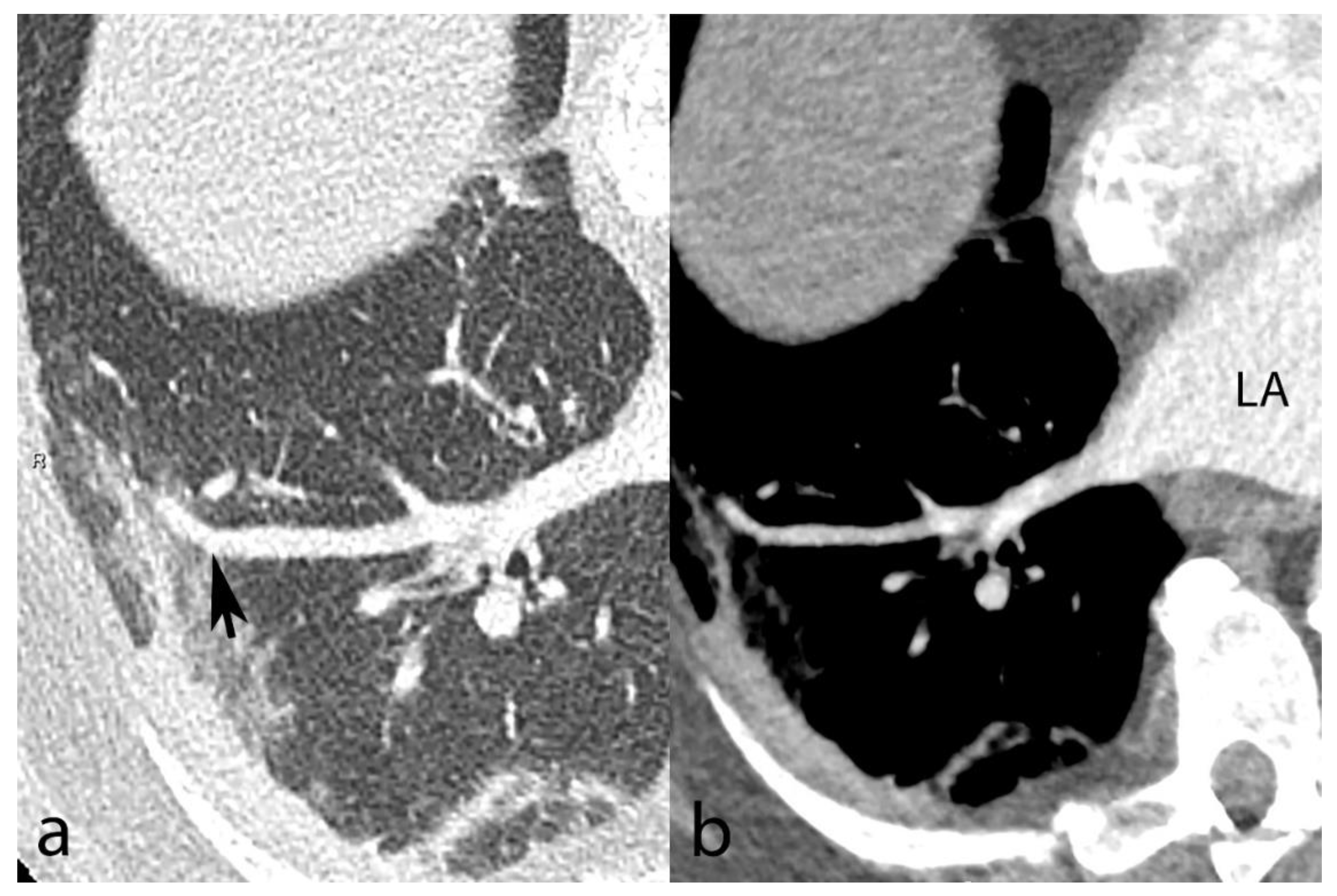 Biomedicines 10 01300 g003