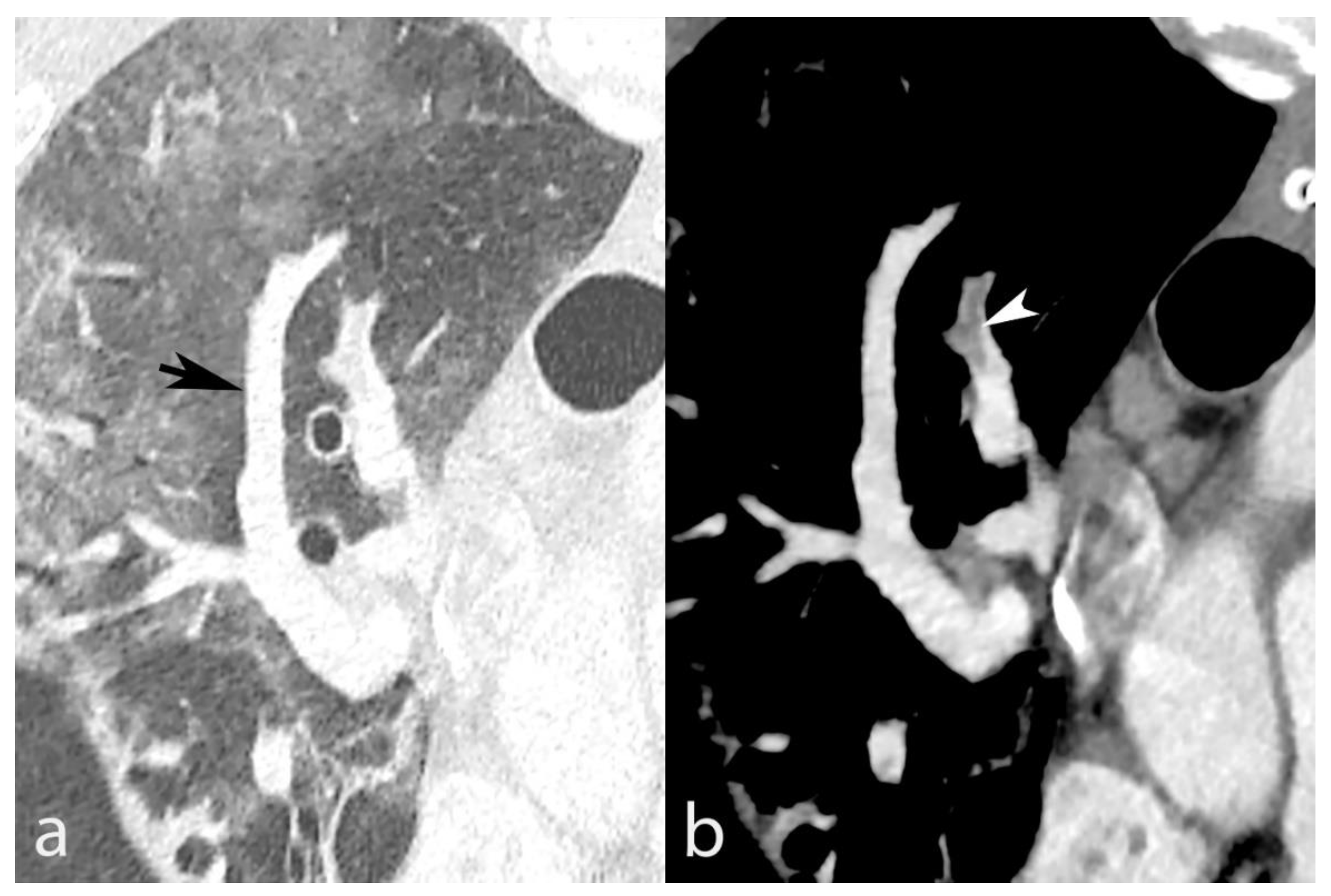 Biomedicines 10 01300 g006