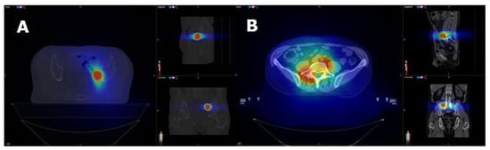 Biomedicines 10 01321 g0a1