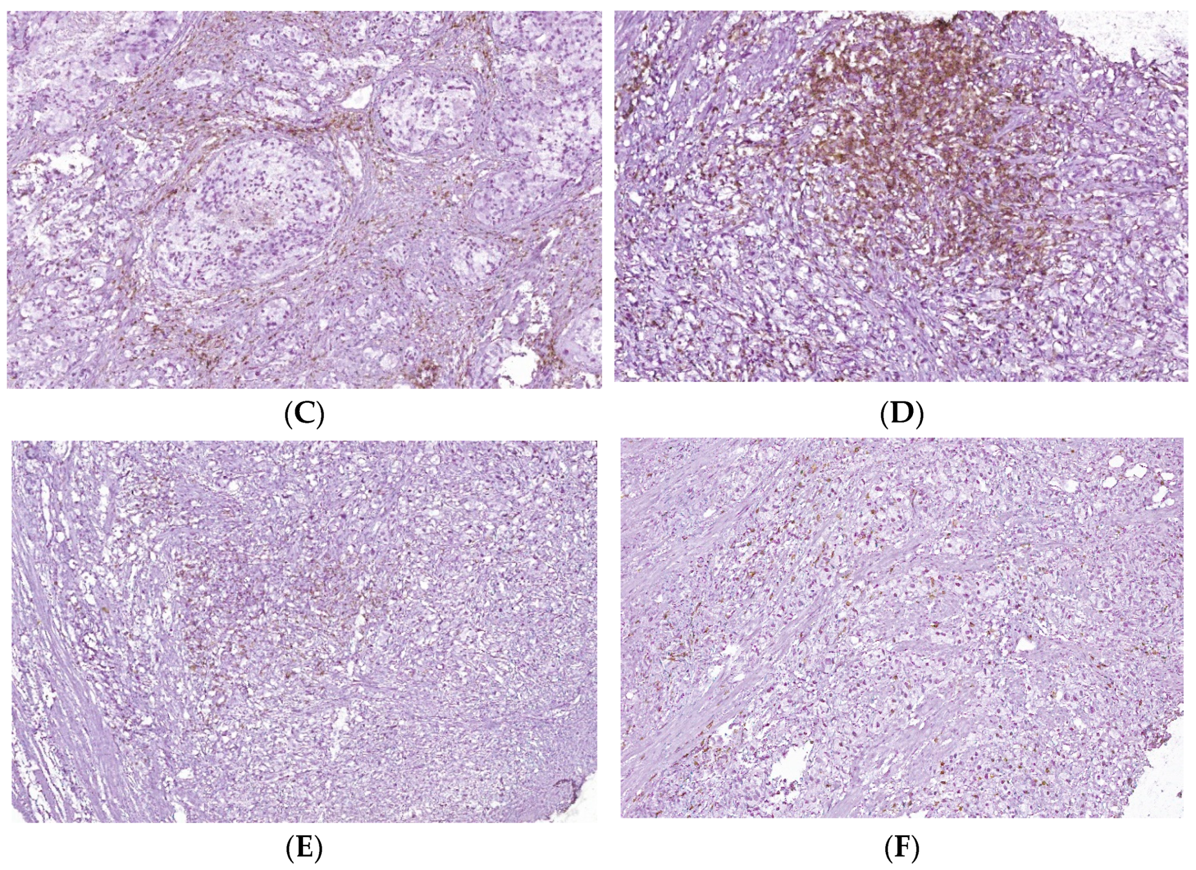 Biomedicines 10 01672 g005b