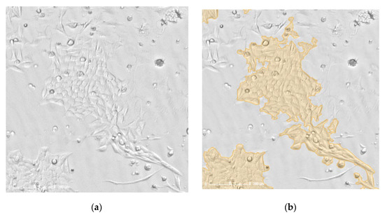 Biomedicines 10 01796 g0a4 550