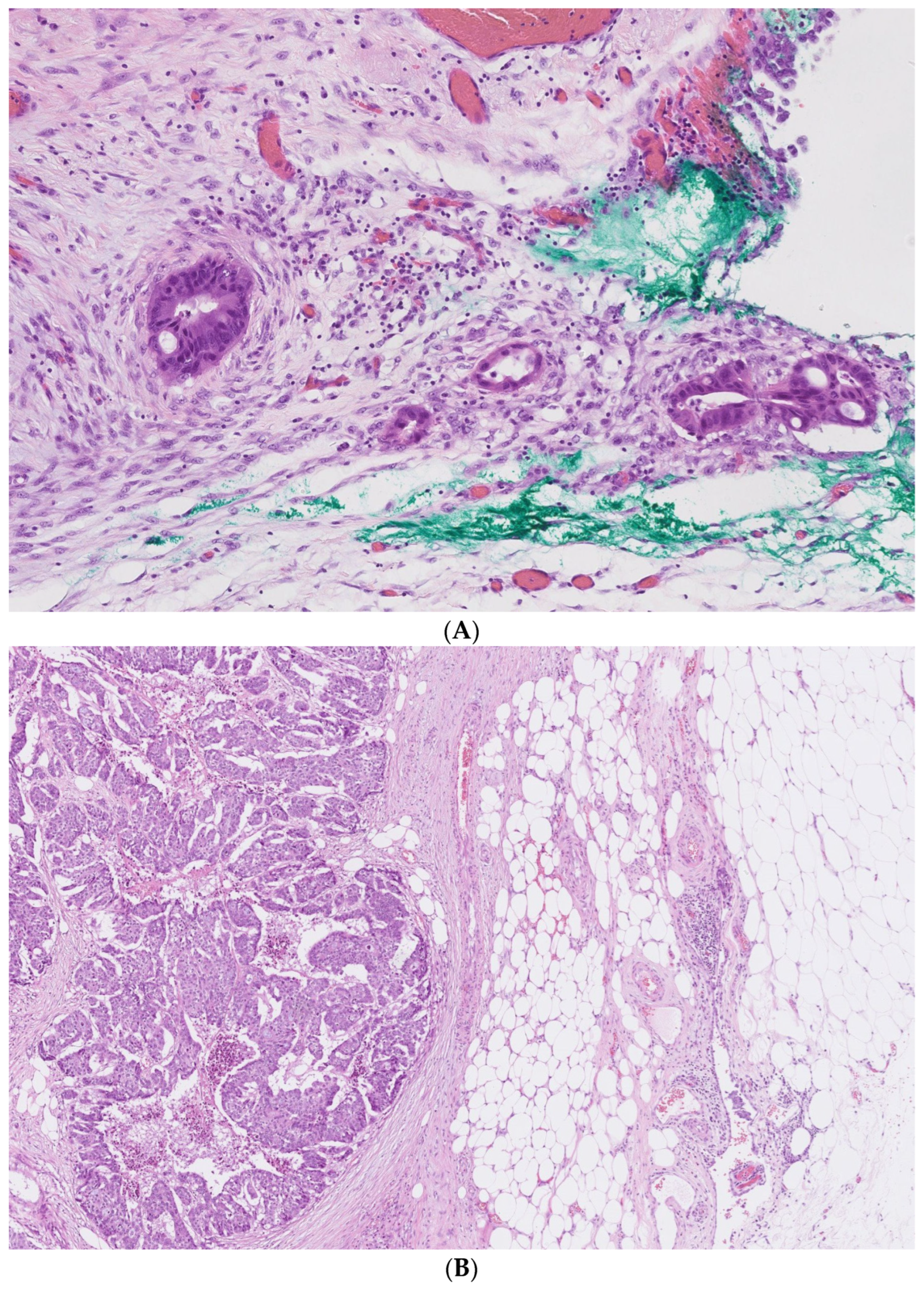 Biomedicines 10 02149 g001 Biomedicines 10 02149 g001