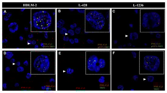 Biomedicines 10 02299 g0a2