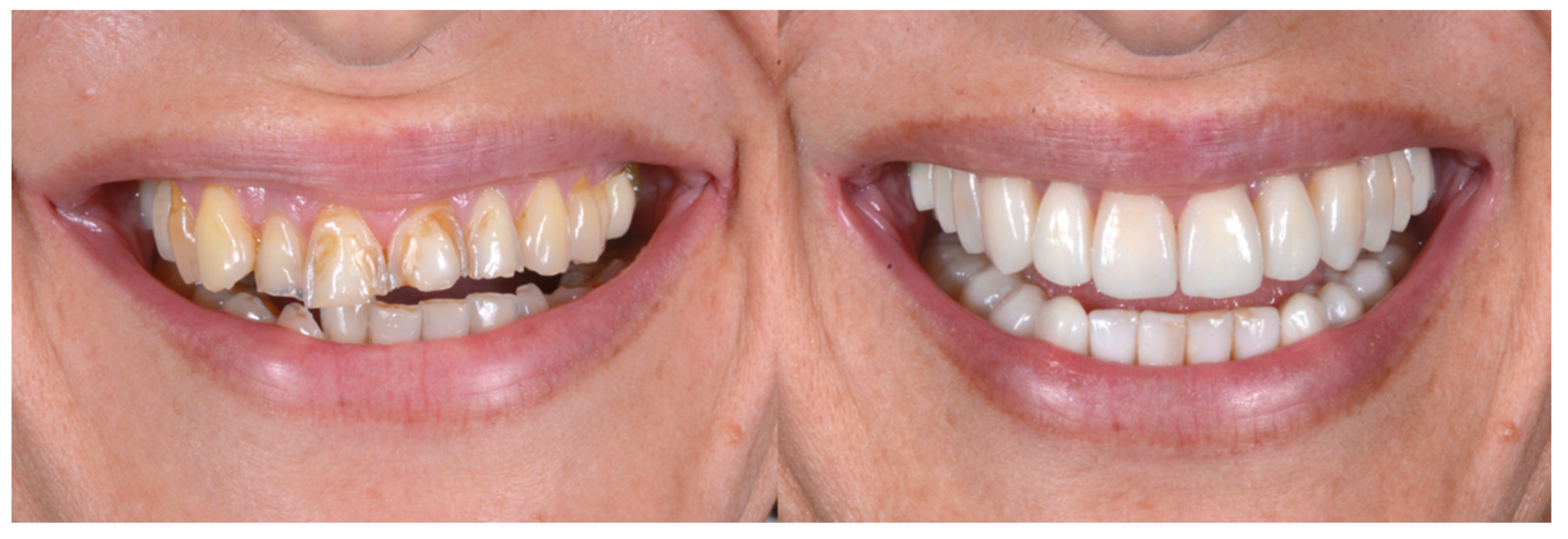 Biomedicines 10 02536 g011