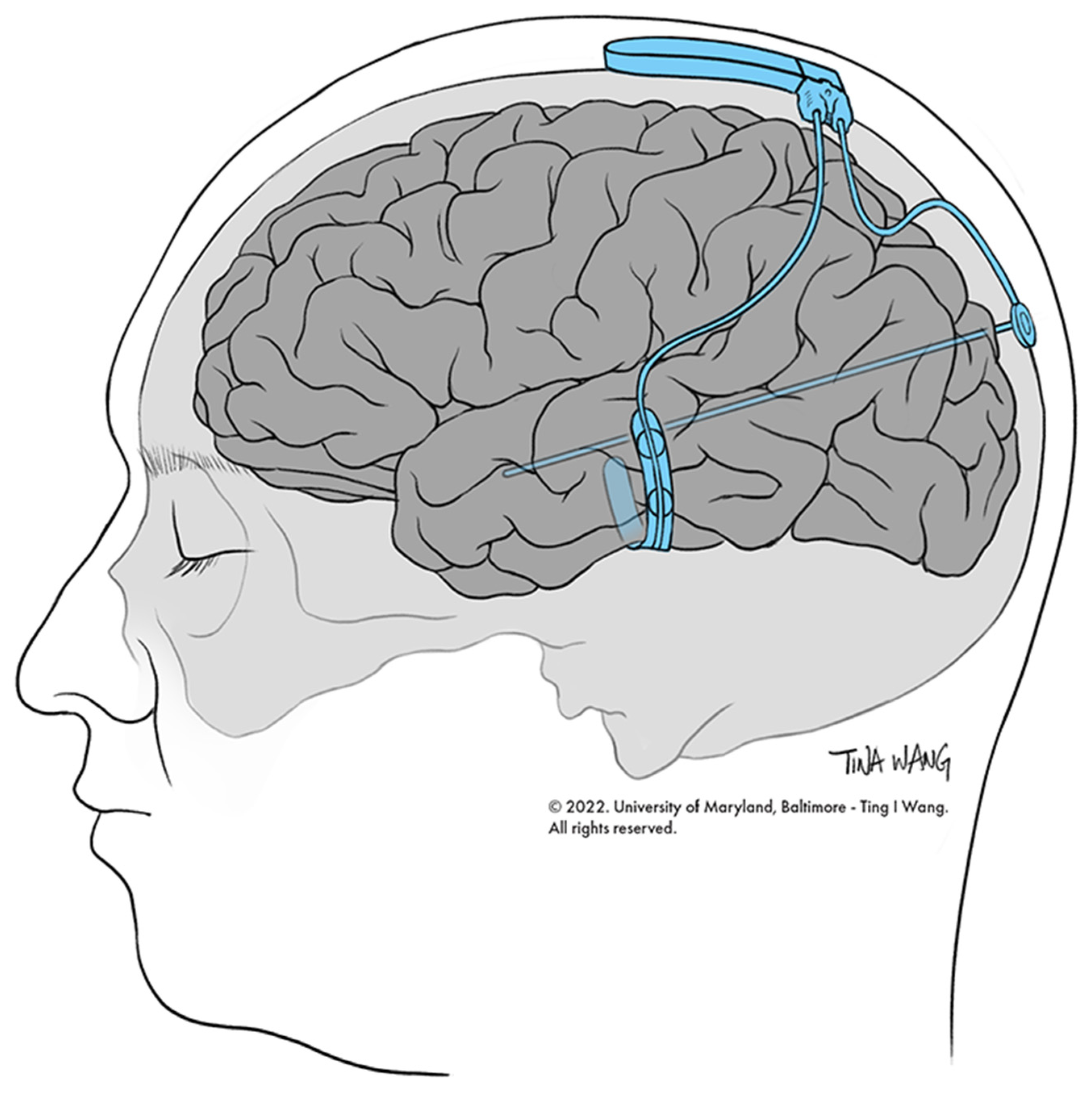 Biomedicines 10 02677 g001 Biomedicines 10 02677 g001
