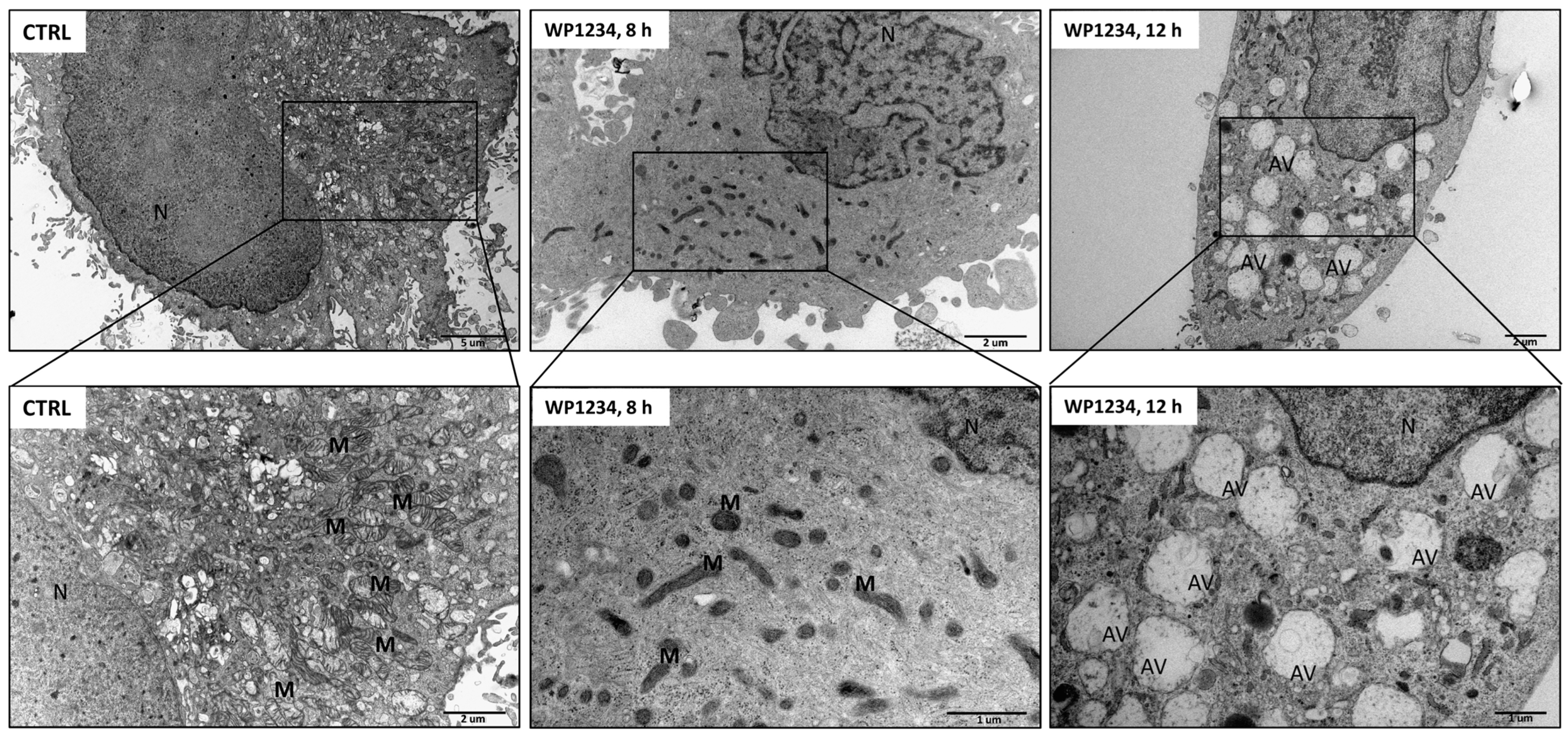 Biomedicines 10 02799 g012
