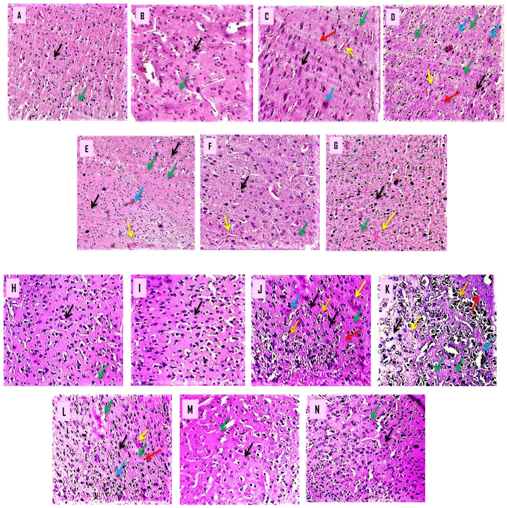 Biomedicines 10 02866 g010 Biomedicines 10 02866 g010