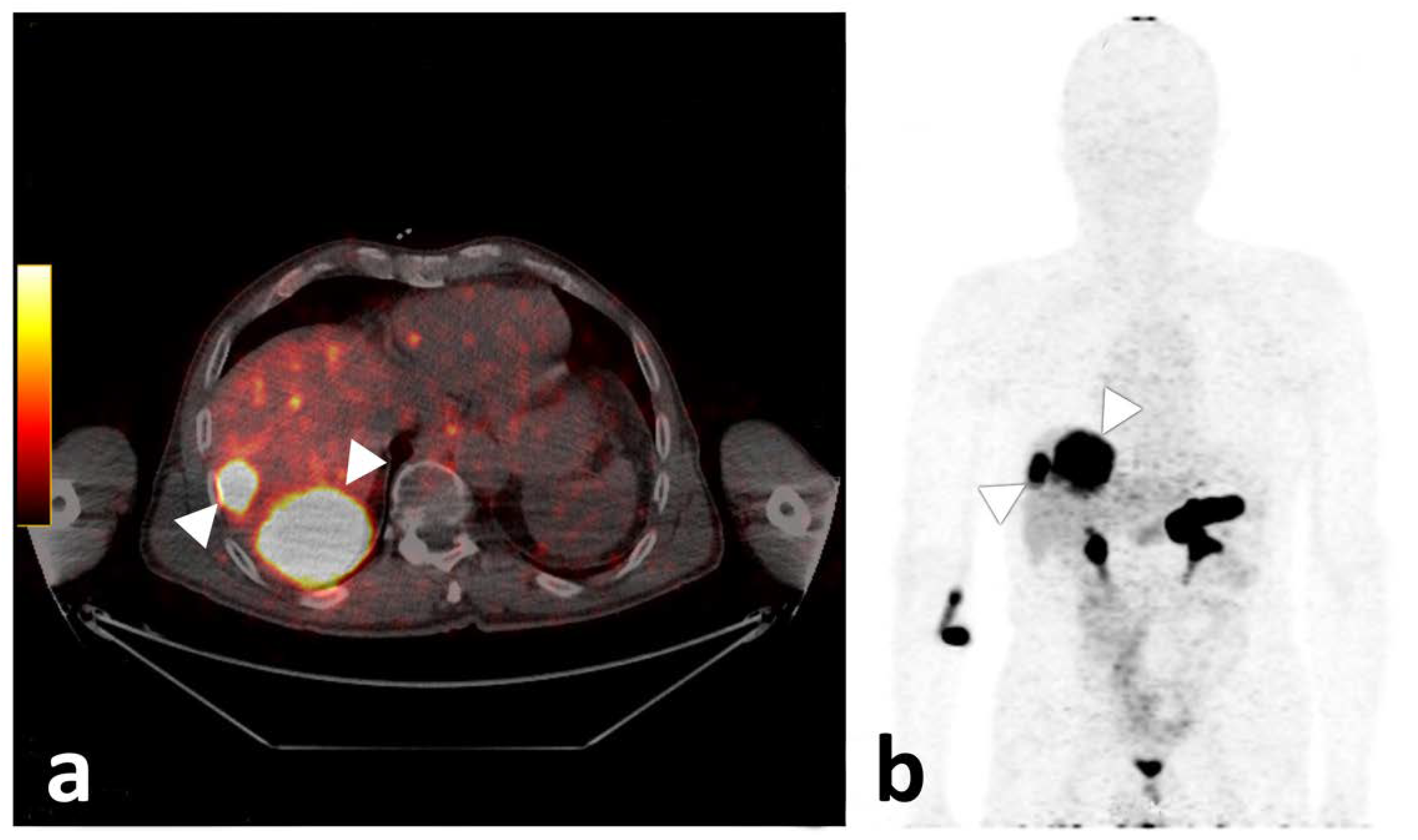 Biomedicines 10 02899 g005 Biomedicines 10 02899 g005