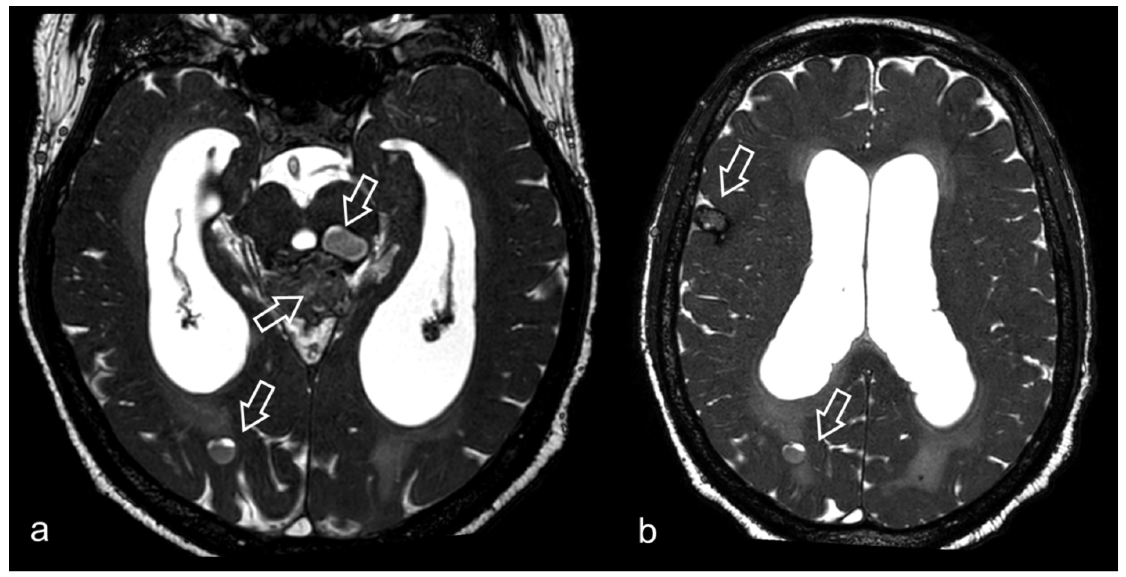 Biomedicines 10 02997 g005