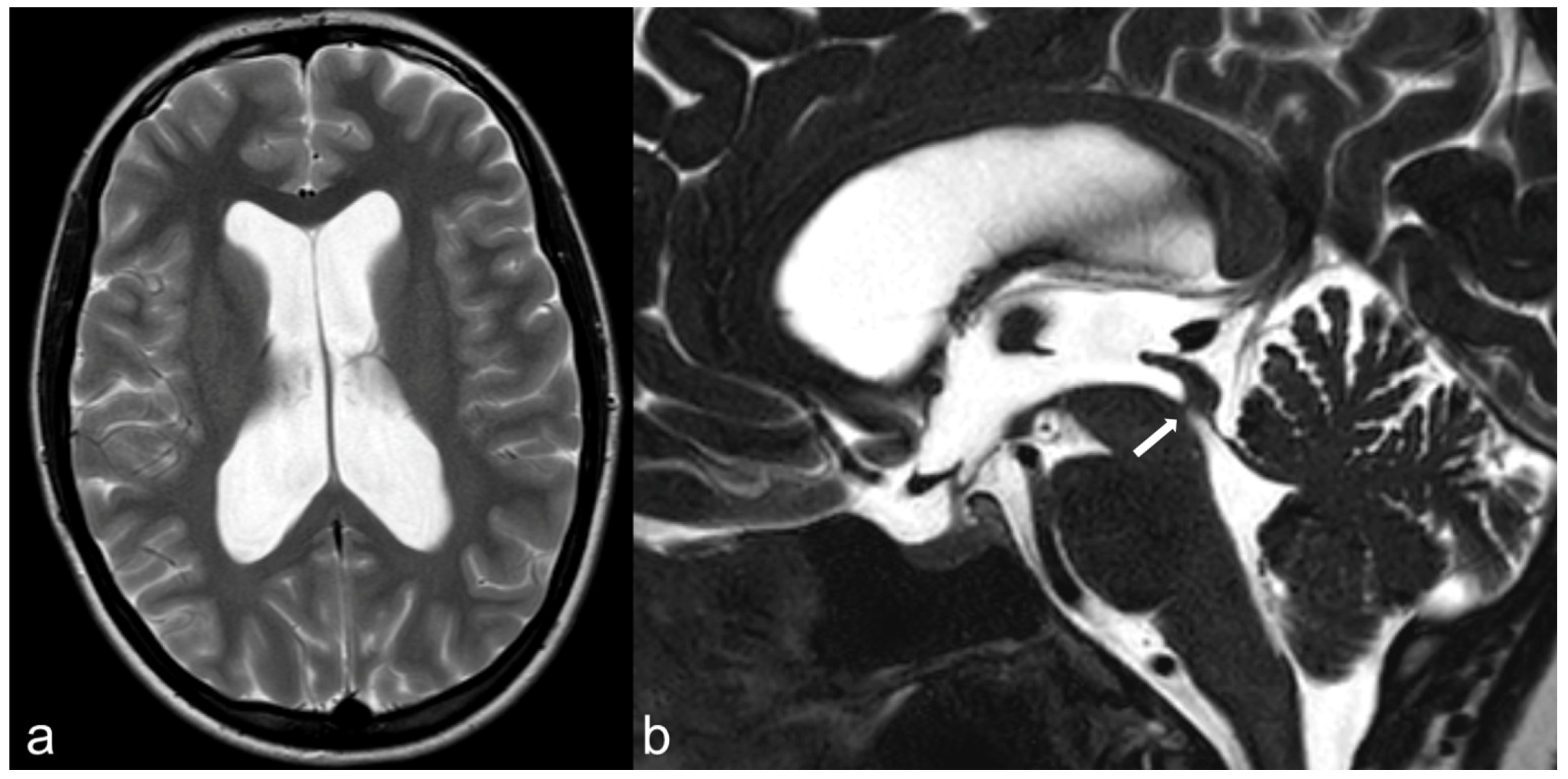 Biomedicines 10 02997 g007