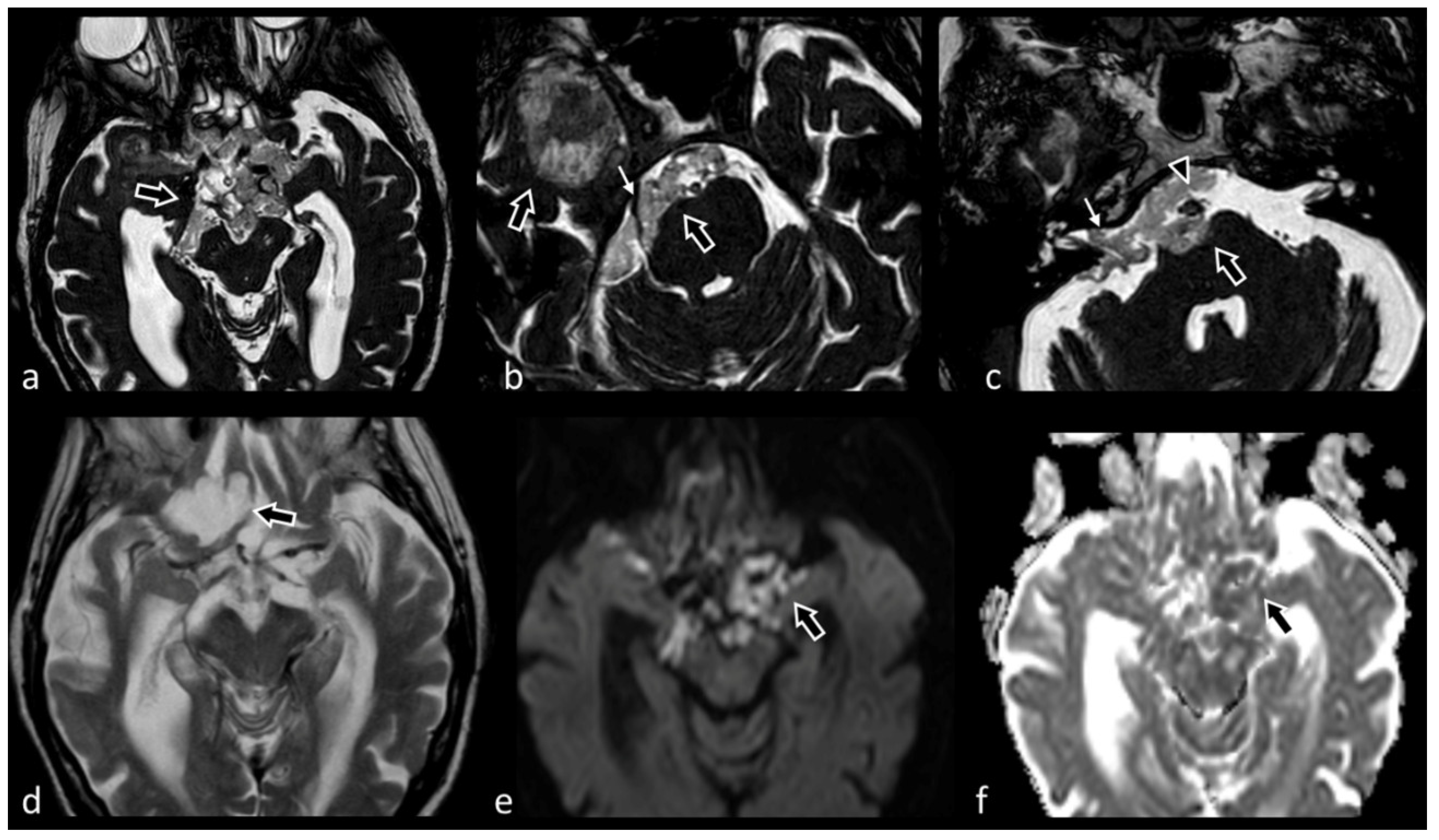 Biomedicines 10 02997 g011