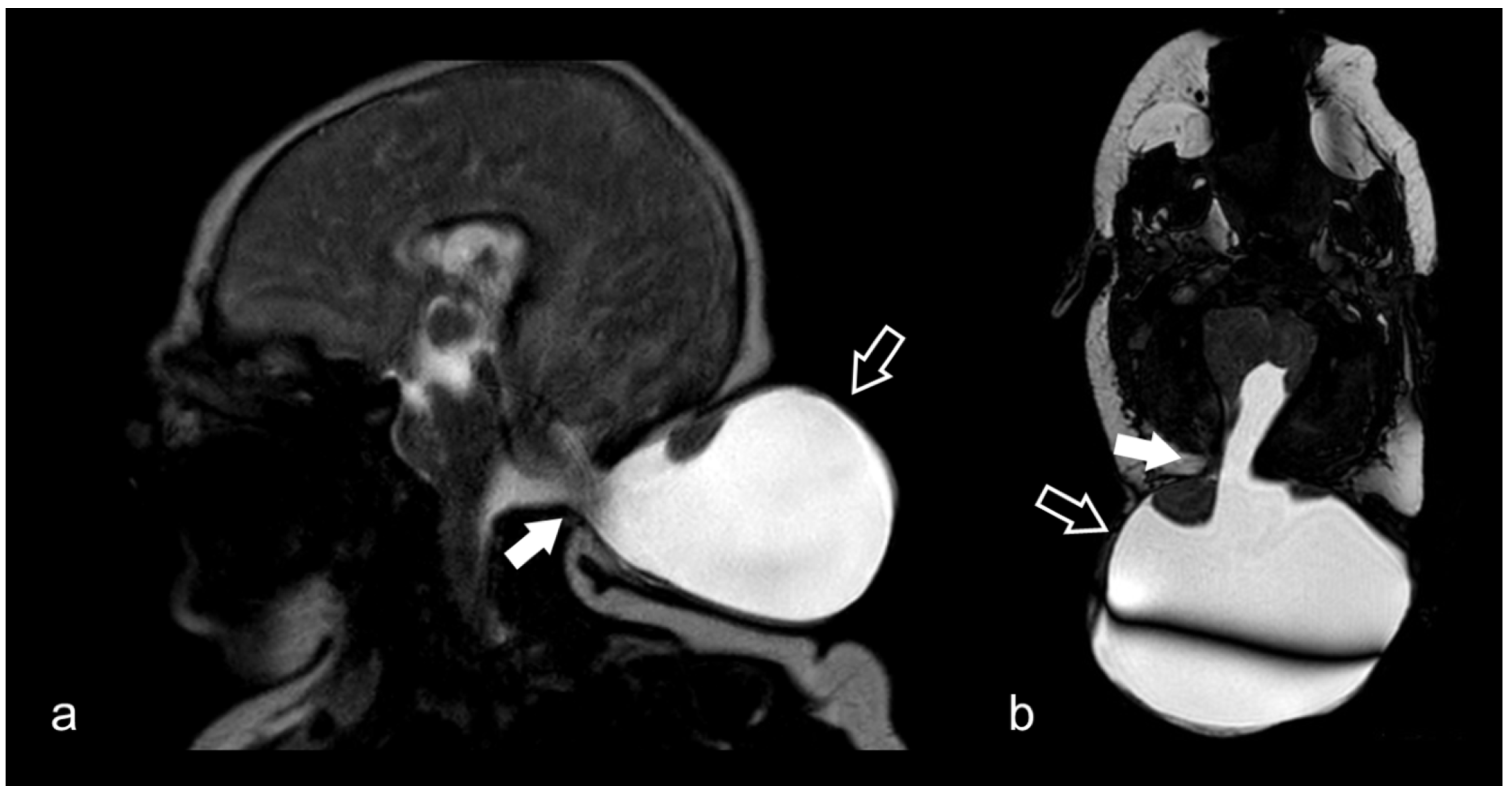 Biomedicines 10 02997 g012