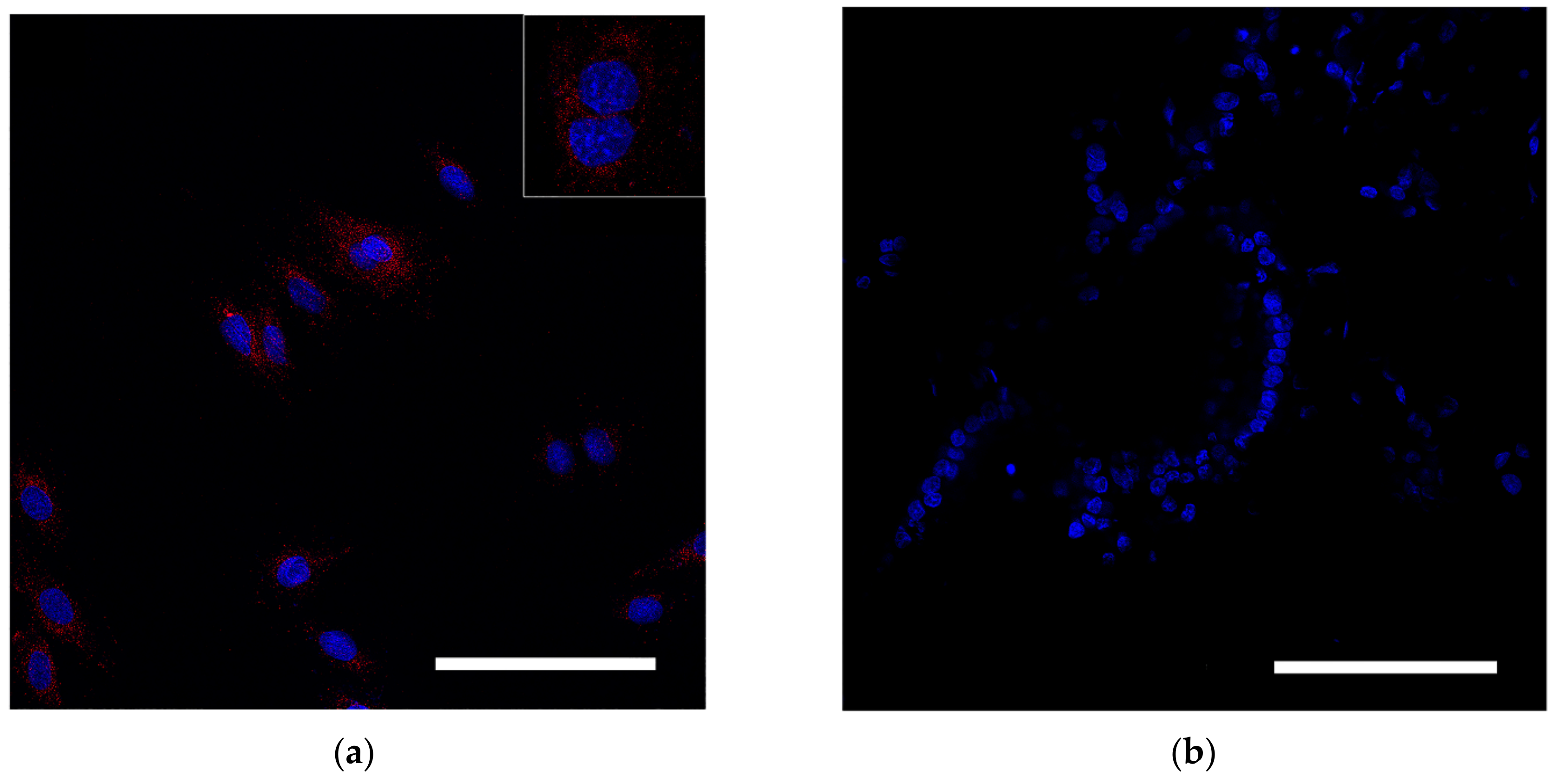 Biomedicines 10 03062 g003 Biomedicines 10 03062 g003