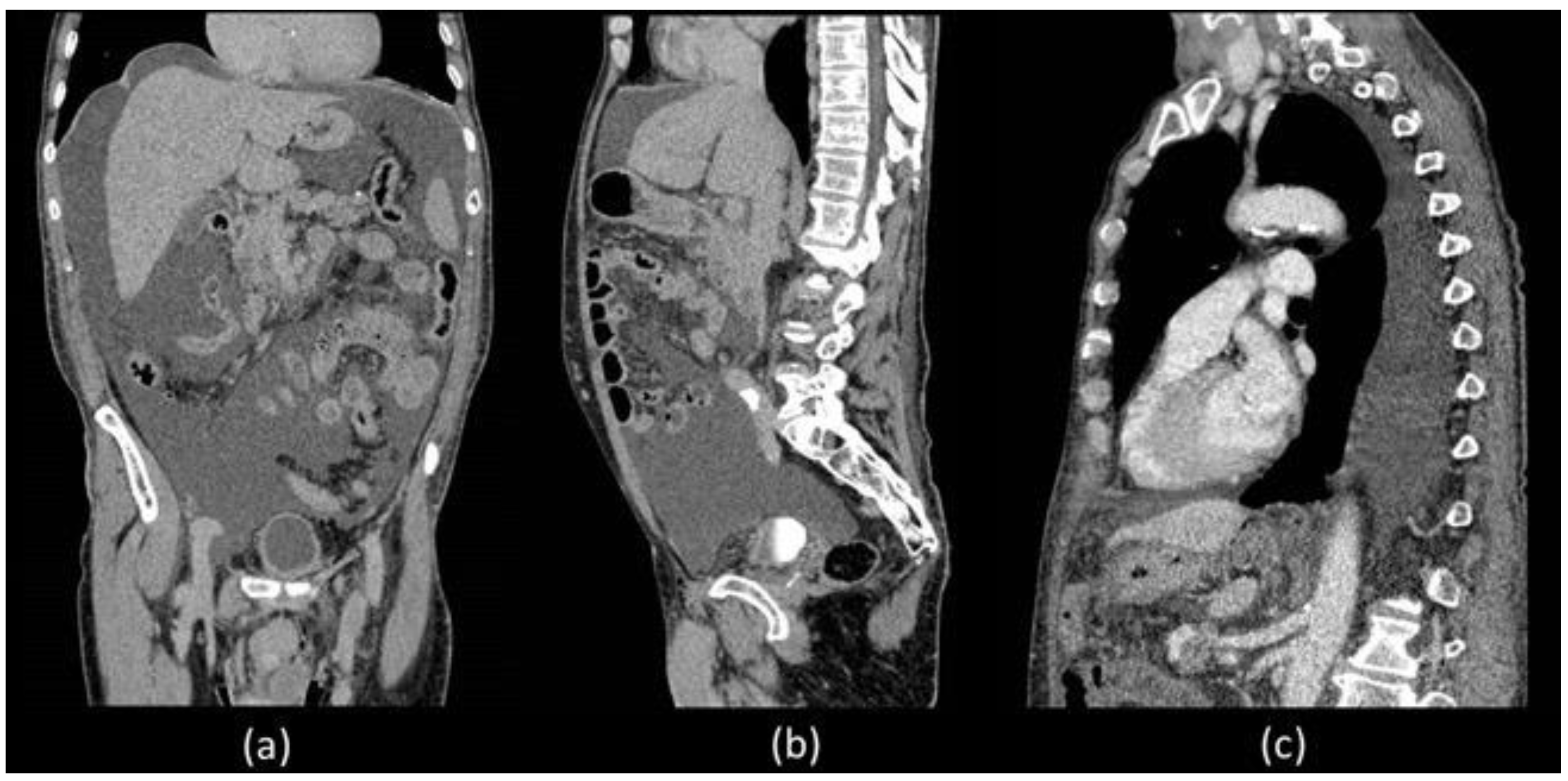 Biomedicines 11 00282 g001 Biomedicines 11 00282 g001