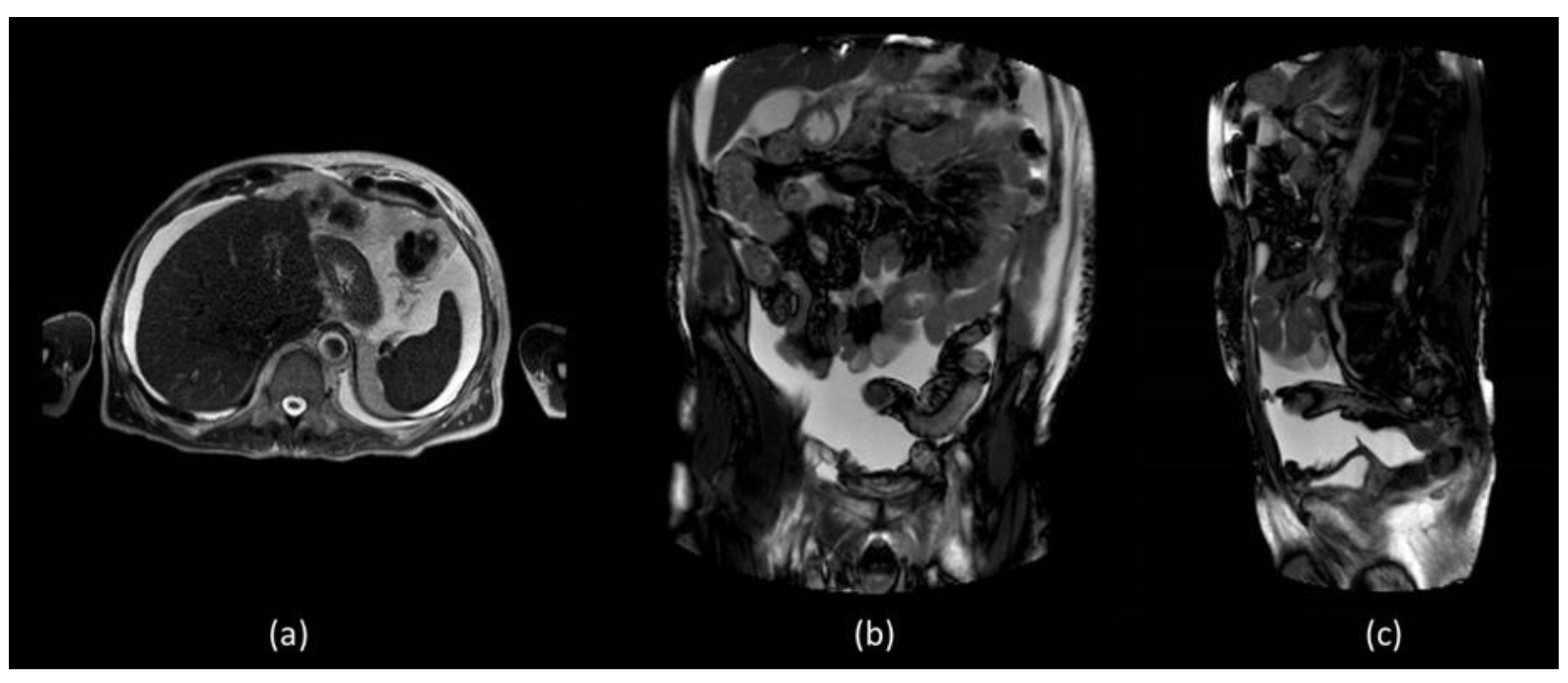 Biomedicines 11 00282 g002 Biomedicines 11 00282 g002
